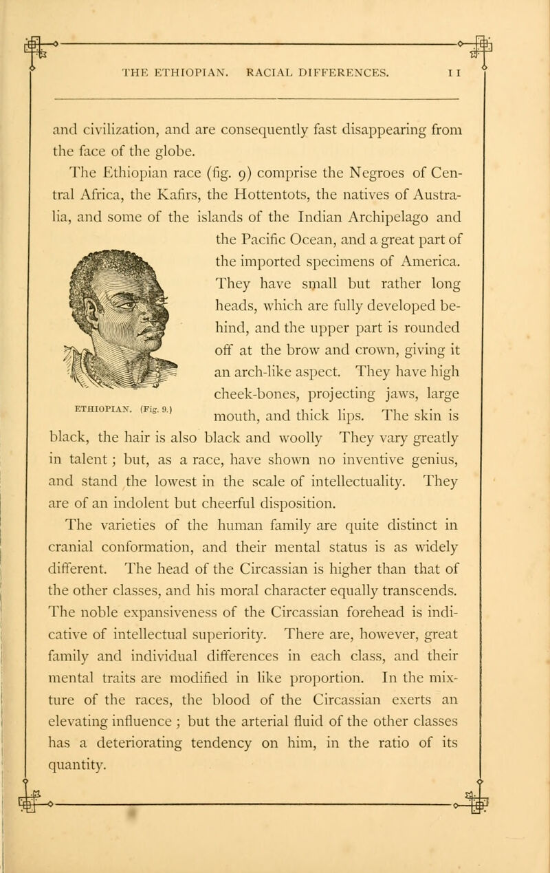 ■+—.\th THE ETHIOPIAN. RACIAL DIFFKRKXCKS. ETHIOPIAN. (Fig. 9.) and civilization, and are consequently fast disappearing from the face of the globe. The Ethiopian race (fig. 9) comprise the Negroes of Cen- tral Africa, the Kafirs, the Hottentots, the natives of Austra- lia, and some of the islands of the Indian Archipelago and the Pacific Ocean, and a great part of the imported specimens of America. They have small but rather long heads, which are fully developed be- hind, and the upper part is rounded off at the brow and crown, giving it an arch-like aspect. They have high cheek-bones, projecting jaws, large mouth, and thick lips. The skin is black, the hair is also black and woolly They vary greatly in talent; but, as a race, have shown no inventive genius, and stand the lowest in the scale of intellectuality. They are of an indolent but cheerful disposition. The varieties of the human family are quite distinct in cranial conformation, and their mental status is as widely different. The head of the Circassian is higher than that of the other classes, and his moral character equally transcends. The noble expansiveness of the Circassian forehead is indi- cative of intellectual superiority. There are, however, great family and individual differences in each class, and their mental traits are modified in like proportion. In the mix- ture of the races, the blood of the Circassian exerts an elevating influence ; but the arterial fluid of the other classes has a deteriorating tendency on him, in the ratio of its quantity.