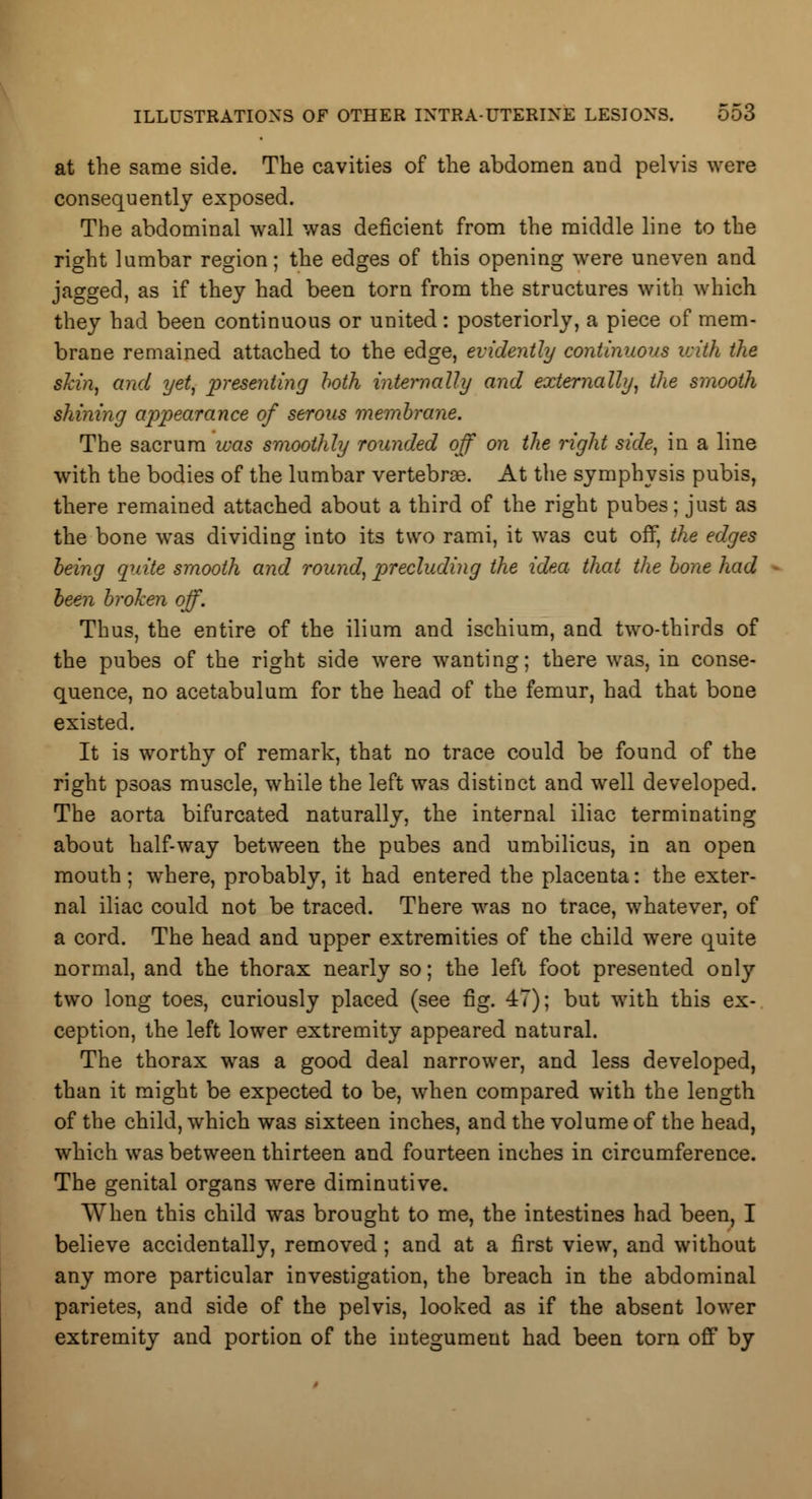 at the same side. The cavities of the abdomen and pelvis were consequently exposed. The abdominal wall was deficient from the middle line to the right lumbar region; the edges of this opening were uneven and jagged, as if they had been torn from the structures with which they had been continuous or united: posteriorly, a piece of mem- brane remained attached to the edge, evidently continuous with the skin, and yet, presenting both internally arid externally, the smooth shining appearance of serous membrane. The sacrum was smoothly rounded off on the right side, in a line with the bodies of the lumbar vertebras. At the symphysis pubis, there remained attached about a third of the right pubes; just as the bone was dividing into its two rami, it was cut off, the edges being quite smooth and round, precluding the idea that the bone had been broken off. Thus, the entire of the ilium and ischium, and two-thirds of the pubes of the right side were wanting; there was, in conse- quence, no acetabulum for the head of the femur, had that bone existed. It is worthy of remark, that no trace could be found of the right psoas muscle, while the left was distinct and well developed. The aorta bifurcated naturally, the internal iliac terminating about half-way between the pubes and umbilicus, in an open mouth; where, probably, it had entered the placenta: the exter- nal iliac could not be traced. There was no trace, whatever, of a cord. The head and upper extremities of the child were quite normal, and the thorax nearly so; the left foot presented only two long toes, curiously placed (see fig. 47); but with this ex- ception, the left lower extremity appeared natural. The thorax was a good deal narrower, and less developed, than it might be expected to be, when compared with the length of the child, which was sixteen inches, and the volume of the head, which was between thirteen and fourteen inches in circumference. The genital organs were diminutive. When this child was brought to me, the intestines had been, I believe accidentally, removed ; and at a first view, and without any more particular investigation, the breach in the abdominal parietes, and side of the pelvis, looked as if the absent lower extremity and portion of the integument had been torn off by