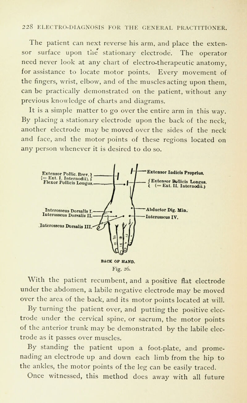 The patient can next reverse his arm, and place the exten- sor surface upon the stationary electrode. The operator need never look at any chart of electro-therapeutic anatomy, for assistance to locate motor points. Every movement of the fingers, wrist, elbow, and of the muscles acting upon them, can be practically demonstrated on the patient, without any previous knowledge of charts and diagrams. It is a simple matter to go over the entire arm in this way. By placing a stationary electrode upon the back of the neck, another electrode may be moved over the sides of the neck and face, and the motor points of these regions located on any person whenever it is desired to do so. Extensor Pollic. Brev ) [= Ext. I. Internodii). f Flexor PoIIteis Lougus Interosseus Dorsalls r. Interosseus Dorsalis II. Interosseus Dorsalis III. Extensor Indicts Proprius. /Extensor Bollicis Longus I (= Ext. II. Internodii.) Abductor Dig. Min. Interosseus IV. back OP HAND. Fig. 26. With the patient recumbent, and a positive flat electrode under the abdomen, a labile negative electrode may be moved over the area of the back, and its motor points located at will. By turning the patient over, and putting the positive elec- trode under the cervical spine, or sacrum, the motor points of the anterior trunk may be demonstrated by the labile elec- trode as it passes over muscles. By standing the patient upon a foot-plate, and prome- nading an electrode up and down each limb from the hip to the ankles, the motor points of the leg can be easily traced. Once witnessed, this method does away with all future