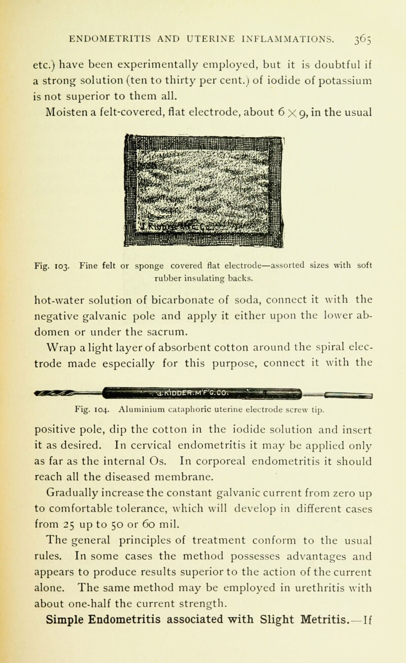 etc.) have been experimentally employed, but it is doubtful if a strong solution (ten to thirty per cent.) of iodide of potassium is not superior to them all. Moisten a felt-covered, flat electrode, about 6 X 9, in the usual Fig. 103. Fine felt or sponge covered flat electrode—assorted sizes with soft rubber insulating backs. hot-water solution of bicarbonate of soda, connect it with the negative galvanic pole and apply it either upon the lower ab- domen or under the sacrum. Wrap alight layer of absorbent cotton around the spiral elec- trode made especially for this purpose, connect it with the _a;K1 ODER- M'FC. CO; —5 *■ J~~ Fig. 104. Aluminium cataphoric uterine electrode screw tip. positive pole, dip the cotton in the iodide solution and insert it as desired. In cervical endometritis it may be applied only as far as the internal Os. In corporeal endometritis it should reach all the diseased membrane. Gradually increase the constant galvanic current from zero up to comfortable tolerance, which will develop in different cases from 25 up to 50 or 60 mil. The general principles of treatment conform to the usual rules. In some cases the method possesses advantages and appears to produce results superior to the action of the current alone. The same method may be employed in urethritis with about one-half the current strength. Simple Endometritis associated with Slight Metritis.—If