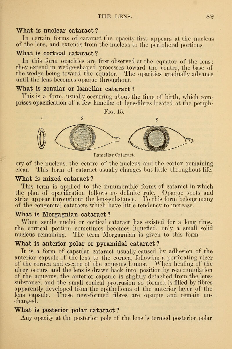 What is nuclear cataract? In certain forms of cataract the opacity first appears at the nucleus of the lens, and extends from the nucleus to the peripheral portions. What is cortical cataract? In this form opacities are first observed at the equator of the lens: they extend in wedge-shaped processes toward the centre, the base of the wedge being toward the equator. The opacities gradually advance until the lens becomes opaque throughout. What is zonular or lamellar cataract? This is a form, usually occurring about the time of birth, which com- prises opacification of a few lamellae of lens-fibres located at the periph- Fig. 15. 2 5 Lamellar Cataract. ery of the nucleus, the centre of the nucleus and the cortex remaining clear. This form of cataract usually changes but little throughout life. What is mixed cataract? This term is applied to the innumerable forms of cataract in which the plan of opacification follows no definite rule. Opaque spots and striae appear throughout the lens-substance. To this form belong many of the congenital cataracts which have little tendency to increase. What is Morgagnian cataract? When senile nuclei or cortical cataract has existed for a long time, the cortical portion sometimes becomes liquefied, only a small solid nucleus remaining. The term Morgagnian is given to this form. What is anterior polar or pyramidal cataract? It is a form of capsular cataract usually caused by adhesion of the anterior capsule of the lens to the cornea, following a perforating ulcer of the cornea and escape of the aqueous humor. When healing of the ulcer occurs and the lens is drawn back into position by reaccumulation of the aqueous, the anterior capsule is slightly detached from the lens- substance, and the small conical protrusion so formed is filled by fibres apparently developed from the epithelioma of the anterior layer of the lens capsule. These new-formed fibres are opaque and remain un- changed. What is posterior polar cataract? Any opacity at the posterior pole of the lens is termed posterior polar