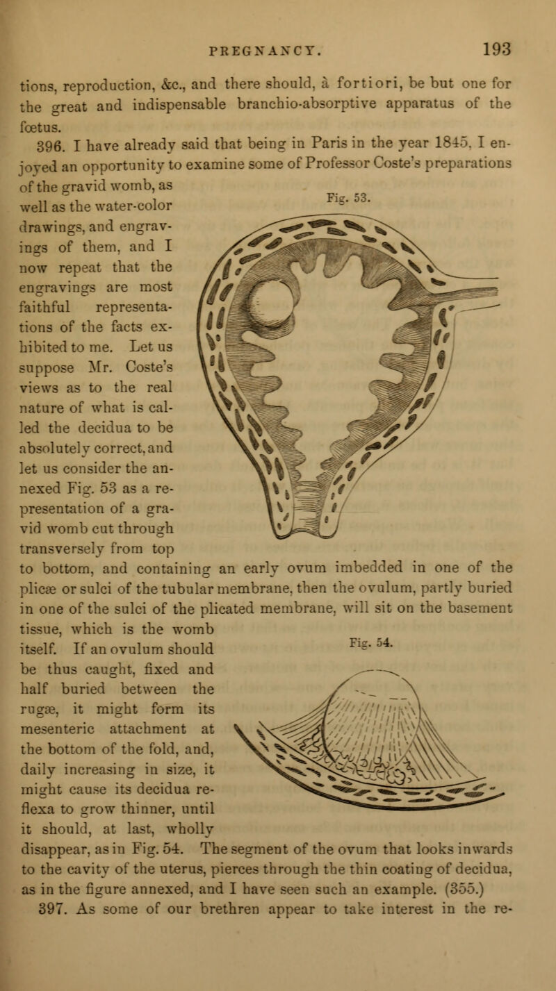 tions, reproduction, &c, and there should, a fortiori, be but one for the <n-eat and indispensable branchio-absorptive apparatus of the feet us. 396. I have already said that being in Paris in the year 1845. I en- joyed an opportunity to examine some of Professor Coste's preparations of the gravid womb, as well as the water-color drawings, and engrav- ings of them, and I now repeat that the engravings are most faithful representa- tions of the facts ex- hibited to me. Let us suppose Mr. Coste's views as to the real nature of what is cal- led the decidua to be absolutely correct.and let us consider the an- nexed Fig. 53 as a re- presentation of a gra- vid womb cut through transversely from top to bottom, and containing an early ovum imbedded in one of the plicae or sulci of the tubular membrane, then the ovulum, partly buried in one of the sulci of the plicated membrane, will sit on the basement tissue, which is the womb itself. If an ovulum should be thus caught, fixed and half buried between the rugae, it might form its mesenteric attachment at the bottom of the fold, and, daily increasing in size, it might cause its decidua re- flexa to grow thinner, until it should, at last, wholly disappear, as in Fig. 54. The segment of the ovum that looks inwards to the cavity of the uterus, pierces through the thin coating of decidua, as in the figure annexed, and I have seen such an example. (355.) 397. As some of our brethren appear to take interest in the re- Fie. 54.