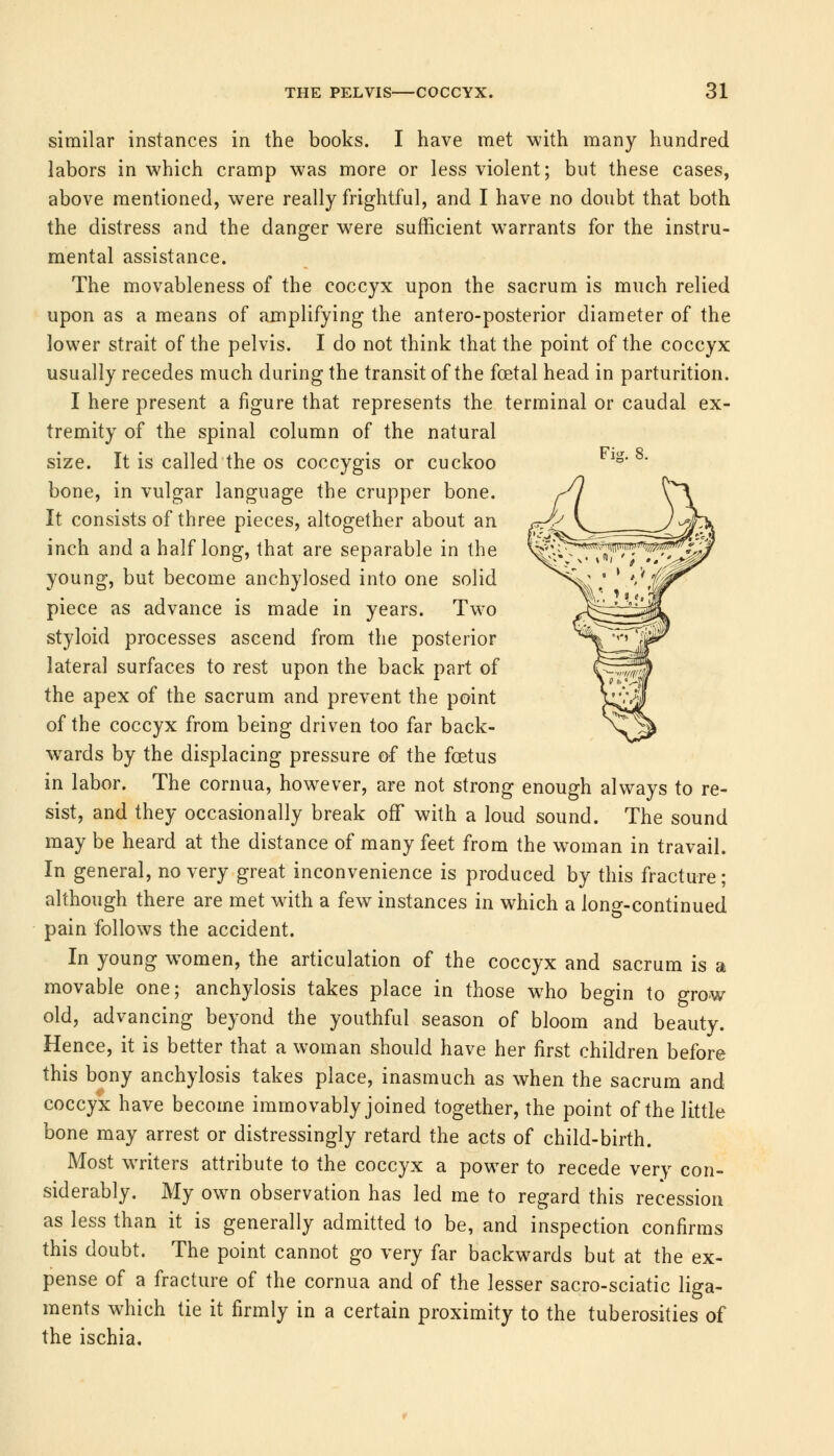 similar instances in the books. I have met with many hundred labors in which cramp was more or less violent; but these cases, above mentioned, were really frightful, and I have no doubt that both the distress and the danger were sufficient warrants for the instru- mental assistance. The movableness of the coccyx upon the sacrum is much relied upon as a means of amplifying the antero-posterior diameter of the lower strait of the pelvis. I do not think that the point of the coccyx usually recedes much during the transit of the foetal head in parturition. I here present a figure that represents the terminal or caudal ex- tremity of the spinal column of the natural size. It is called the os coccygis or cuckoo bone, in vulgar language the crupper bone. It consists of three pieces, altogether about an inch and a half long, that are separable in the young, but become anchylosed into one solid piece as advance is made in years. Two styloid processes ascend from the posterior lateral surfaces to rest upon the back part of the apex of the sacrum and prevent the point of the coccyx from being driven too far back- wards by the displacing pressure of the foetus in labor. The cornua, however, are not strong enough always to re- sist, and they occasionally break off with a loud sound. The sound may be heard at the distance of many feet from the woman in travail. In general, no very great inconvenience is produced by this fracture; although there are met with a few instances in which a long-continued pain follows the accident. In young women, the articulation of the coccyx and sacrum is a movable one; anchylosis takes place in those who begin to grow old, advancing beyond the youthful season of bloom and beauty. Hence, it is better that a woman should have her first children before this bony anchylosis takes place, inasmuch as when the sacrum and coccyx have become immovably joined together, the point of the little bone may arrest or distressingly retard the acts of child-birth. Most waiters attribute to the coccyx a power to recede very con- siderably. My own observation has led me to regard this recession as less than it is generally admitted to be, and inspection confirms this doubt. The point cannot go very far backwards but at the ex- pense of a fracture of the cornua and of the lesser sacro-sciatic liga- ments which tie it firmly in a certain proximity to the tuberosities of the ischia.