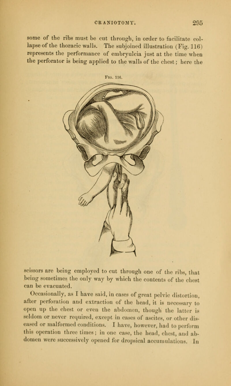 some of the ribs must be cut through, in order to facilitate col- lapse of the thoracic walls. The subjoined illustration (Fig. 116) represents the performance of embryulcia just at the time when the perforator is being applied to the walls of the chest; here the Fig. 11 scissors are being employed to cut through one of the ribs, that being sometimes the only way by which the contents of the chest can be evacuated. Occasionally, as I have Baid, in cases of great pelvic distortion, after perforation and extraction of the head, it is necessary to open u]) the chest or even the abdomen, though the latter is seldom or never required, except in cases of ascites, or other dis- eased or malformed conditions. I haw, however, had to perform this operation three times; in our case, the head, chest, and ab- domen were successively opened for dropsical accumulations. In