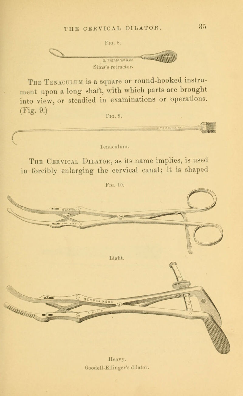 THE CERVICAL DILATOR Fig. 8. *_ IN & re Siias'.- retractor. The Tenaculum is a square or round-hooked instru- ment upon a long shaft, with which parts are brought into view, or steadied in examinations or operations. (Fig. 9.) Fig. 9. • r Tenaculum The Cervical Dilator, as its name implies, is used in forcibly enlarging the cervical canal; it is shaped Fig. in. II. avy. odell-Ellinger'e dilator.