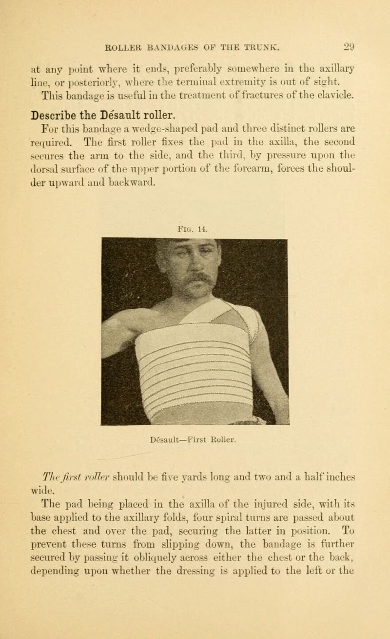 at any point where it ends, preferably somewhere in the axillary line or posteriorly, where the terminal extremity is ont of sight. This bandage is useful in the treatment of fractures of the clavicle. Describe the Desault roller. For this bandage a wedge-shaped pad and three distinct rollers are required. The first roller fixes the pad in the axilla, the second secures the ana to the side, and the third, by pressure upon the dorsal surface of the upper portion of the forearm, forces the shoul- der upward and backward. Pig. 14. Desault—First Roller. Tin first mil, r should be five yards long and two and a half inches wide. The pad being placed in the axilla of the injured side, with its base applied to the axillary folds, four spiral turns are passed about the chest and over the pad, securing the latter in position. To prevent these turns from slipping down, the bandage is further secured by passing it obliquely across either the chest or the back, depending upon whether the dressing is applied to the left or the