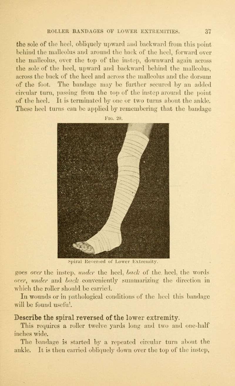 the sole of the heel, obliquely upward and backward from this point behind the malleolus and around the back of the heel, forward over the malleolus, over the top of the instep, downward again across the sole of the heel, upward and backward behind the malleolus, across the back of the heel and across the malleolus and the dorsum of the foot. The bandage may be further secured by an added circular turn, passing from the top of the instep around the point of the heel. It is terminated by one or two turns about the ankle. These heel turns can be applied by remembering that the bandage Fig. 20. Reversed of Lower Extremity. goes over the instep, under the heel, bade of the. heel, the words over, under and buck conveniently summarizing the direction in which the roller should be carried. In wounds or in pathological conditions of the heel this bandage will be found useful. Describe the spiral reversed of the lower extremity. This requires a roller twelve yards long and two and one-half inches wide. The bandage is started by a repeated circular turn about the ankle. It is then carried obliquely down over the top of the instep,