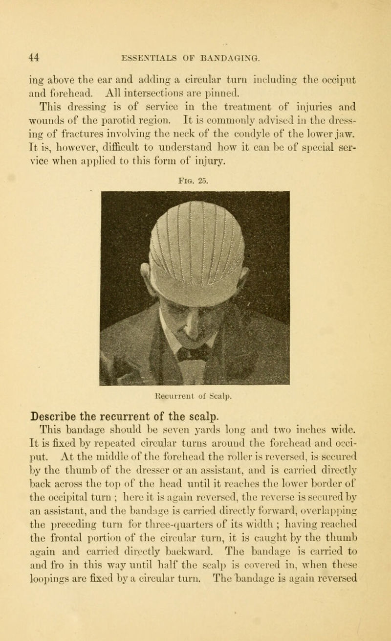 ing above the ear and adding a circular turn including the occiput and forehead. All intersections are pinned. This dressing is of service in the treatment of injuries and wounds of the parotid region. It is commonly advised in the dress- ing of fractures involving the neck of the condyle of the lower jaw. It is, however, difficult to understand how it can be of special ser- vice when applied to this form of injury. Recurrent of Scalp. Describe the recurrent of the scalp. This bandage should be seven yards long and two inches wide. It is fixed by repeated circular turns around the forehead and occi- put. At the middle of the forehead the roller is reversed, is secured by the thumb of the dresser or an assistant, and is carried directly back across the top of the head until it reaches the lower border of the occipital turn ; here it is again reversed, the reverse is secured by an assistant, and the bandage is carried directly forward, overlapping the preceding turn for three-quarters of its width ; having reached the frontal portion of the circular turn, it is caught by the thumb again and carried directly backward. The bandage is carried to and fro in this way until half the seal]) is covered in. when these loopings are fixed by a circular turn. The bandage is again reversed