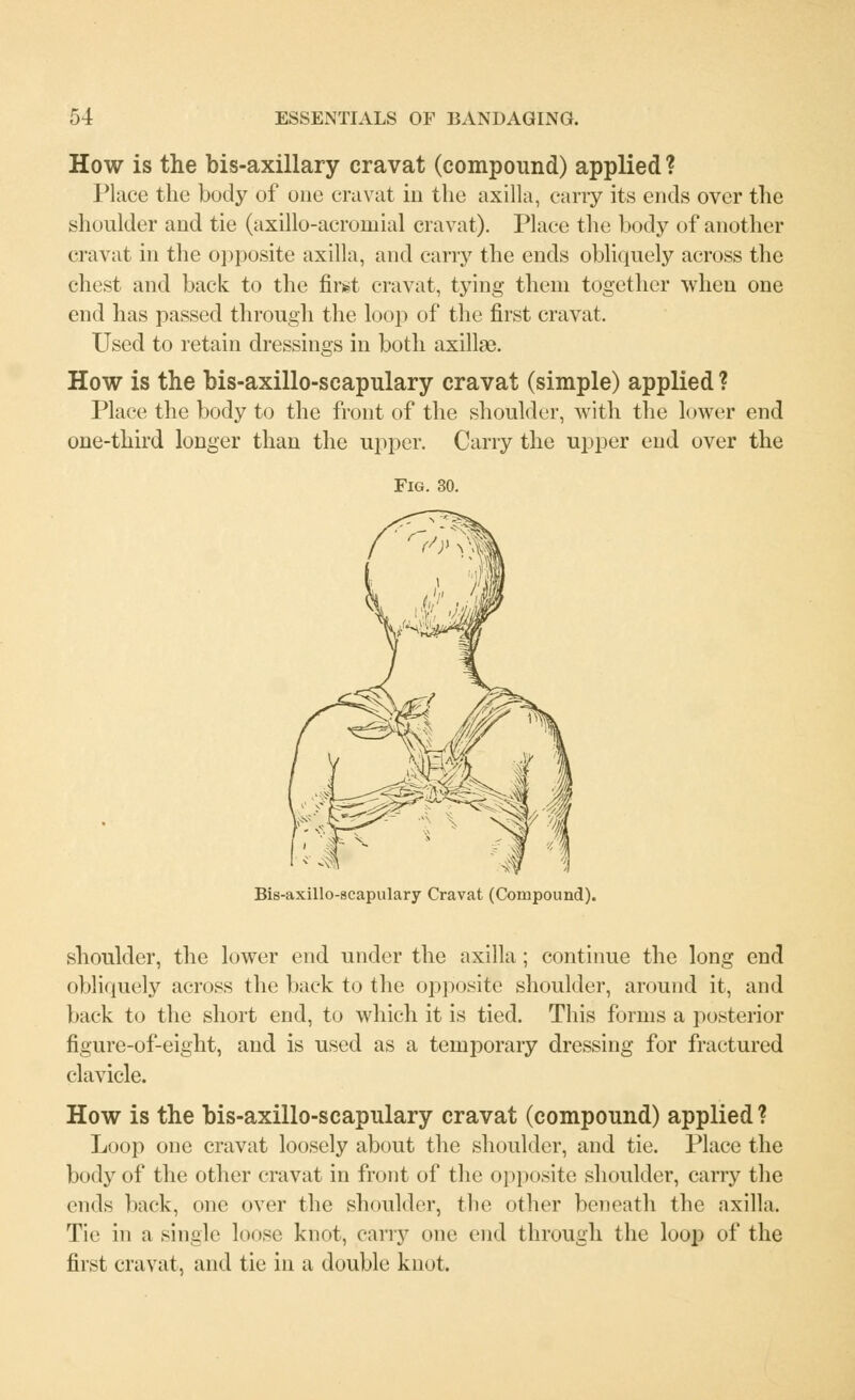 How is the bis-axillary cravat (compound) applied ? Place the body of one cravat in the axilla, carry its ends over the shoulder and tie (axillo-acromial cravat). Place the body of another cravat in tlie opposite axilla, and carry the ends obliquely across the chest and back to the first cravat, tying them together when one end has passed through the loop of the first cravat. Used to retain dressings in both axillae. How is the bis-axillo-scapulary cravat (simple) applied ? Place the body to the front of the shoulder, with the lower end one-third longer than the upper. Carry the upper end over the Fig Bis-axillo-scapulary Cravat (Compound). shoulder, the lower end under the axilla; continue the long end obliquely across the back to the opposite shoulder, around it, and back to the short end, to which it is tied. This forms a posterior figure-of-eight, and is used as a temporary dressing for fractured clavicle. How is the bis-axillo-scapulary cravat (compound) applied ? Loop one cravat loosely about the shoulder, and tie. Place the body of the other cravat in front of the opposite shoulder, carry the ends back, one over the shoulder, the other beneath the axilla. Tic in a single loose knot, cany one end through the loop of the first cravat, and tie in a double knot.