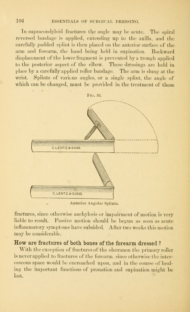 In supracondyloid fractures the angle may be acute. The spiral reversed bandage is applied, extending up to the axilla, and the carefully padded splint is then placed on the anterior surface of the arm and forearm, the hand being held in supination. Backward displacement of the lower fragment is prevented by a trough applied to the posterior aspect of the elbow. These dressings are held in place by a carefully applied roller bandage. The arm is slung at the wrist. Splints of various angles, or a single splint, the angle of which can be changed, must be provided in the treatment of these Fig. 53. • Anterior Angular Splints. fractures, since otherwise anchylosis or impairment of motion is very liable to result, Passive motion should be begun as soon as acute inflammatory symptoms have subsided. After two weeks this motion may be considerable How are fractures of both bones of the forearm dressed ? With the exception of fractures of the olecranon the primary roller is never applied to fractures of the forearm, since otherwise the inter- osseous space would be encroached upon, and in the course of heal- ing the important functions of pronation and supination might be lost.