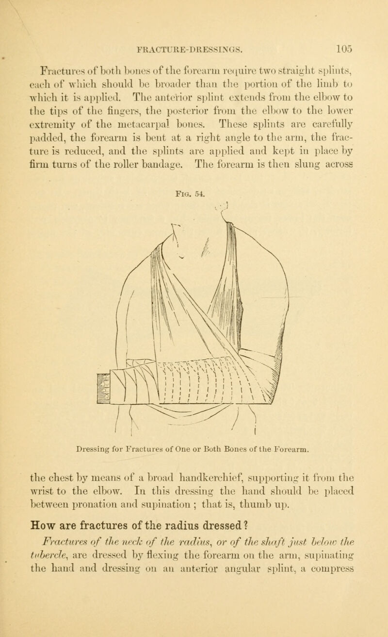 Fractures of both bones of the forearm require two straight splints, each of which should be broader than the portion of the limb to which it is applied. The anterior splint extends from the elbow to the tips of the fingers, the posterior from the elbow to the lower extremity of the metacarpal bones. These splints are carefully padded, the forearm is bent at a right angle to the arm, the frac- ture is reduced, and the splints are applied and kept in place by firm turns of the roller bandage. The forearm is then slung across Fig. 54. Dressing for Fractures of One or Both Bones of the Forearm. the chest by means of a broad handkerchief, supporting it from the wrist to the elbow. In this dressing the hand should be placed between pronation and supination ; that is, thumb up. How are fractures of the radius dressed ? Fractures of the neck of the radius, or of the shaft just below the tubercle, are dressed by flexing the forearm on the arm, supinating the hand and dressing on an anterior angular splint, a compress