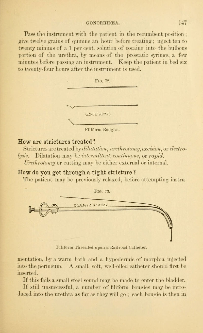 Pass the instrument with the patient in the recumbent position : give twelve grains of quinine an hour before treating ; inject ten to twenty minims of a 1 percent, solution of cocaine into the bulbous portion of the urethra, by means of the prostatic syringe, a few minutes before passing an instrument. Keep the patient in bed six to twenty-four hours after the instrument is used. Fig. 72. \ Filiform Bougies. How are strictures treated ? Strictures are treated by dilatation, urethrotomy\eoccision, or electro- lysis. Dilatation may be intermittent, continuous, or rapid. Urethrotomy or cutting may be either external or internal. How do you get through a tight stricture ? The patient may be previously relaxed, before attempting instru- Fig. 73. Filiform Threaded upon a Railroad Catheter. mentation, by a warm bath and a hypodermic of morphia injected into the perineum. A small, soft, well-oiled catheter should first be inserted. If this fails a small steel sound may be made to enter the bladder. If still unsuccessful, a number of filiform bougies may be intro- duced into the urethra as far as they will go ; each bougie is then in