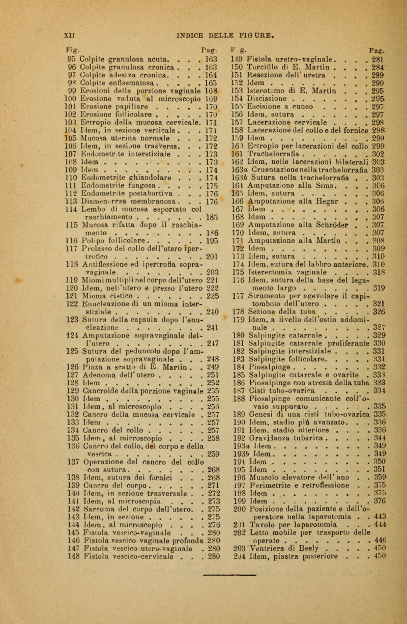 Fig. Pag. 95 Colpite granulosa acuta. . . . 163 96 Colpite granulosa cronica . . . 163 97 Colpite adesiva cronica. . . . 164 98 Colpite enfisematosa 165 99 Erosioni della porzione vaginale 168 100 Erosione veduta al microscopio 169 101 Erosione papillare 170 102 Erosione follicolare 170 103 Eutropio della mucosa cervicale. 171 104 l'iena, in sezione verticale. . . 171 105 Mucosa uterina normale . . . 172 106 Idem, in sez'une trasversa. . . 172 107 Endometrte interstiziale . . . 173 108 Idem 173 109 Idem 174 110 Endometrite ghiandolare . . . 174 111 Endometrite fungosa 175 112 Endometrite postabortiva . . . 176 113 Dismem rraa membranosa . . . 176 114 Lembo di mucosa esportato col raschiamento ....... 185 115 Mucosa rifatta dopo il raschia- mento 186 116 Polipo follicolare 195 117 Prolasso del collo dell'utero iper- trofico 201 118 Antiflessione ed ipertrofia sopra- vaginale. 203 119 Miomimultiplinel corpo dell'utero 221 120 Idem, nell'utero e presso l'utero 222 121 Mioma cistico 225 122 Enucleazione di un mioma inter- stiziale 240 123 Sutura della capsula dopo l'enu- cleazione 241 124 Amputazione sopravaginale del- l'utero 217 125 Sutura del peduncolo dopo l'am- putazione sopravaginale . . . 248 126 Pinza a scatto di E. Martin . . 249 127 Adenoma dell'utero 251 128 Idem 252 129 Cancroide della porzione vaginale 255 130 Idem 255 131 Idem, al microscopio .... 256 132 Cancro della mucosa cervicale . 257 133 Idem 257 134 Cancro del collo 257 135 Idem, al microscopio .... 258 136 Cancro del collo, del corpo e della vescica 259 137 Operazione del cancro del collo con sutura 268 138 Idem, sutura dei fornici . . . 268 1S9 Cancro del corpo 271 140 Idem, in sezione trasversale . . 272 141 Idem, al microscopio 273 142 Sarcoma del corpo dell'utero. . 275 143 Idem, in sezione 275 144 Idem, al microscopio .... 276 145 Fistola ve>cico-vaginale . . . 280 146 Fistola vescico-vaginale profonda 280 147 Fistola vescico-utero-vaginale . 280 148 Fistola vescico-cervicale . . . 280 F g. Pag. 149 Fistola uretro-vaginale. . . . 281 150 Torcitìlo di E. Martin .... 284 151 Resezione dell'uretra .... 289 lfS2 Idem 290 153 Isterotomo di E. Martin . . . 295 154 Discissione 295 155 Escisione a cuneo 297 156 Idem, sutura 297 157 Lacerazione cervicale .... 298 158 Lacerazione del collo e del fornice 298 159 Idem . . 299 16') Ectropio per lacerazioni del collo 299 161 Trachelorrafia 302 162 Idem, nelle lacerazioni bilaterali 303 163a Cruentazione nella trachelorrafia 303 1636 Sutura nella trachelorrafia . . 303 161 Amputaz one alla Sims. . . . 3C6 165 Idem, sutura 306 166 Amputazione alla Hegar . . . 306 167 Idem 306 168 Idem 307 169 Amputazione alla Schròder . . 307 170 Idem, sutura 307 171 Amputazione alla Martin . . . 308 172 Idem 309 173 Idem, sutura 310 174 Idem, sutura del labbro anteriore. 310 175 Isterectomia vaginale .... 318 176 Idem, sutura della base del lega- mento largo 319 177 Strumento per agevolare il capi- tombolo dell'utero 321 178 Sezione della tuba 326 179 Idem, a livello dell'ostio addomi- nale 327 180 Salpingite catarrale 329 181 Salpingite catarrale proliferante 330 182 Salpingite interstiziale .... 331 183 Salpingite follicolare 331. 184 Piosalpinge 332 185 Salpingite catarrale e ovarite . 333 186 Piosalpinge con atresia della tuba 333 187 Cisti tubo-ovarica 334 188 Piosalpinge comunicante coll'o- vaio suppuralo 335 189 Genesi di una cisti tubo-ovarica 335 190 Idem, stadio più avanzato. . . 336 191 Idem, stadio ulteriore .... 336 192 Gravidanza tubarica 344 193a Idem 349 1936 Idem 349 194 Idem 350 195 Idem 351 196 Muscolo elevatore dell' ano . . 359 i97 Perimetrite e retroflessione . . 375 198 Idem 375 199 Idem 376 200 Posizione della paziente e dell'o- peratore nella laparotomia . . 443 2)1 Tavolo per laparotomia . . . 444 202 Letto mobile per trasporto delle operate 446 203 Ventriera di Beely 450 2i>4 Idem, piastra posteriore . . . 450