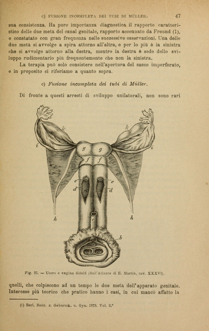 sua consistenza. Ha pure importanza diagnostica il rapporto caratteri- stico delle due metà del canal genitale, rapporto accennato da Freund (1), e constatato con gran frequenza nelle successive osservazioni. Una delle due metà si avvolge a spira attorno all'altra, e per lo più è la sinistra che si avvolge attorno alla destra, mentre la destra è sede dello svi- luppo rudimentario più frequentemente che non la sinistra. La terapia può solo consistere nell'apertura del sacco imperforato, e in proposito ci riferiamo a quanto sopra. e) Fusione incompleta dei tubi di Muller. Di fronte a questi arresti di sviluppo unilaterali, non sono rari Fig. 25. — Utero e vagina didelfi (dall'Atlante di E. Martin, tav. XXXVI;. quelli, che colpiscono ad un tempo le due meta dell'apparato genitale. Interesse più teorico che pratico hanno i casi, in cui mancò affatto la (1) Beri. Beitr. z. Geburtsk. u. Gyn. 1873. Voi. 2.°