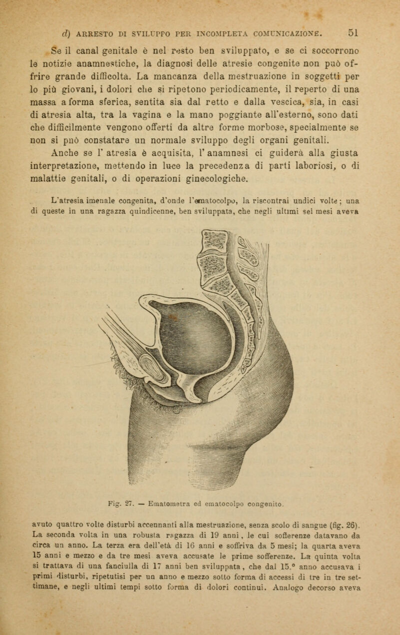 Se il canal genitale è nel resto ben sviluppato, e se ci soccorrono le notizie anamnestiche, la diagnosi delle atresie congenite non può of- frire grande difficolta. La mancanza della mestruazione in soggetti per lo più giovani, i dolori che si ripetono periodicamente, il reperto di una massa a forma sferica, sentita sia dal retto e dalla vescica, sia, in casi di atresia alta, tra la vagina e la mano poggiante all'esterno, sono dati che difficilmente vengono offerti da altre forme morbose, specialmente se non si può constatare un normale sviluppo degli organi genitali. Anche se 1' atresia è acquisita, 1' anamnesi ci guiderà alla giusta interpretazione, mettendo in luce la precedenza di parti laboriosi, o di malattie genitali, o di operazioni ginecologiche. Latresia imenale congenita, d'onde l'einatocolpo, la riscontrai undici volte ; una di queste in una ragazza quindicenne, ben sviluppata, che negli ultimi sei mesi aveva (7. — Ematometra ed ematocolpo congenito. avuto quattro volte disturbi accennanti alla mestruazione, seDza scolo di sangue (fìg. 26). La seconda volta in una robusta ragazza di 19 anni, le cui sofferenze datavano da circa un anno. La terza era dell'età di 16 anni e soffriva da 5 mesi; la quarta aveva 15 anni e mezzo e da tre mesi aveva accusate le prime sofferenze. La quinta volta si trattava di una fanciulla di 17 anni ben sviluppata, che dal 15.° anno accusava i primi disturbi, ripetutisi per un anno e mezzo sotto forma di accessi di tre in tre set- timane, e negli ultimi tempi sotto forma di dolori continui. Analogo decorso aveva
