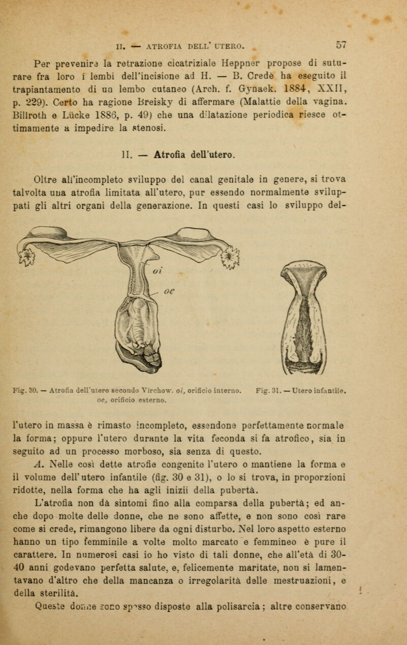 Per prevenir la retrazione cicatriziale Heppner propose di sutu- rare fra loro i lembi dell'incisione ai H. — B. Credè ha eseguito il trapiantamene di un lembo cutaneo (Arch. f. Gynaek. 1884, XXII, p. 229). Certo ha ragione Breisky di affermare (Malattie della vagina. Billroth e Lùcke 1886, p. 49) che una d'iatazione periodica riesce ot- timamente a impedire la stenosi. II. Atrofìa dell'utero. Oltre ali'incompleto sviluppo del canal genitale in genere, si trova talvolta una atrofìa limitata all'utero, pur essendo normalmente svilup- pati gli altri organi della generazione. In questi casi lo sviluppo dei- Fi?. SO. Atrofia dell'utero secondo Virckow. o!„ orificio interno. oe. orificio esterno. Fiff. 31. — Utero infantile. l'utero in massa è rimasto incompleto, essendone perfettamente normale la forma; oppure l'utero durante la vita feconda si fa atrofico, sia in seguito ad un processo morboso, sia senza di questo. A, Nelle così dette atrofìe congenite l'utero o mantiene la forma e il volume dell'utero infantile (fig. 30 e 31), o lo si trova, in proporzioni ridotte, nella forma che ha agli inizii della pubertà. L'atrofìa non dà sintomi fino alla comparsa della pubertà; ed an- che dopo molte delle donne, che ne sono affette, e non sono così rare come si crede, rimangono libere da ogni disturbo. Nel loro aspetto esterno hanno un tipo femminile a volte molto marcato e femmineo è pure il carattere. In numerosi casi io ho visto di tali donne, che all'età di 30- 40 anni godevano perfetta salute, e. felicemente maritate, non si lamen- tavano d'altro che della mancanza o irregolarità delle mestruazioni, e della sterilità. Queste donae seco spasso disposte alla polisarcia : altre conservano