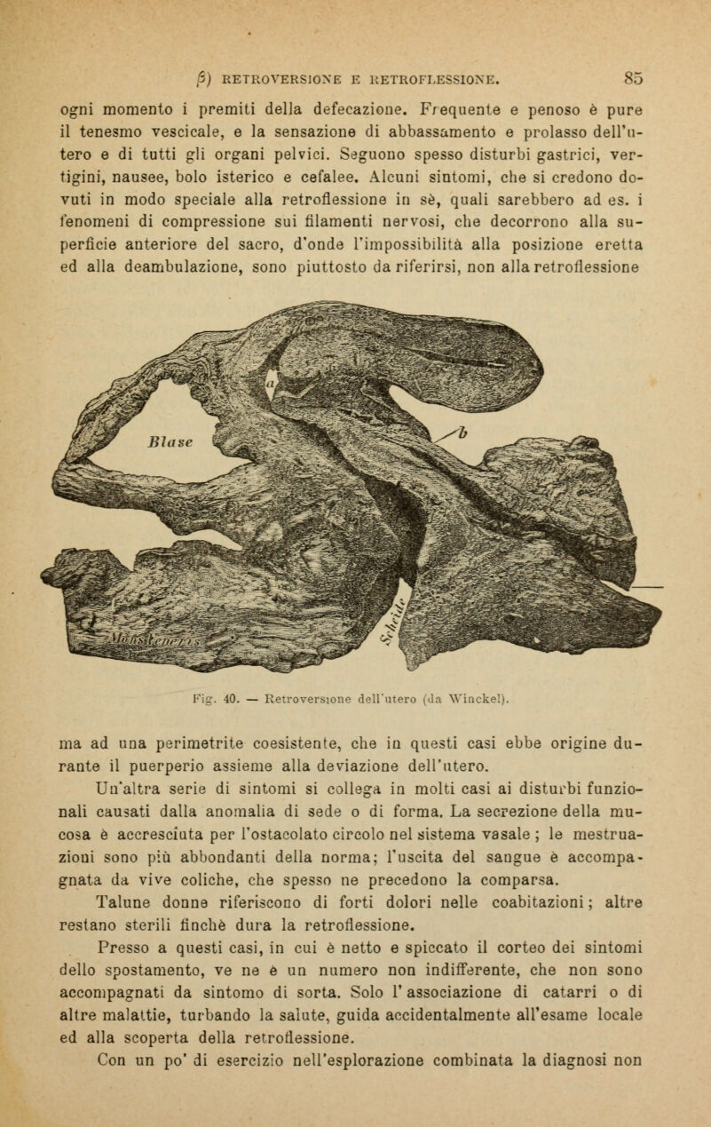 ogni momento i premiti della defecazione. Frequente e penoso è pure il tenesmo vescicale, e la sensazione di abbassamento e prolasso dell'u- tero e di tutti gli organi pelvici. Seguono spesso disturbi gastrici, ver- tigini, nausee, bolo isterico e cefalee. Alcuni sintomi, che si credono do- vuti in modo speciale alla retroflessione in sé, quali sarebbero ad es. i fenomeni di compressione sui filamenti nervosi, che decorrono alla su- perficie anteriore del sacro, d'onde l'impossibilità alla posizione eretta ed alla deambulazione, sono piuttosto da riferirsi, non alla retroflessione Fig. 40. — Retroversione dell'utero (da Winckel). ma ad una perimetrite coesistente, che in questi casi ebbe origine du- rante il puerperio assieme alla deviazione dell'utero. Un'altra serie di sintomi si collega in molti casi ai disturbi funzio- nali causati dalla anomalia di sede o di forma. La secrezione della mu- cosa è accresciuta per l'ostacolato circolo nel sistema vasale ; le mestrua- zioui sono più abbondanti della norma; l'uscita del sangue è accompa- gnata da vive coliche, che spesso ne precedono la comparsa. Talune donne riferiscono di forti dolori nelle coabitazioni ; altre restano sterili finché dura la retroflessione. Presso a questi casi, in cui è netto e spiccato il corteo dei sintomi dello spostamento, ve ne è un numero non indifferente, che non sono accompagnati da sintomo di sorta. Solo l'associazione di catarri o di altre malattie, turbando la salute, guida accidentalmente all'esame locale ed alla scoperta della retroflessione. Con un po' di esercizio nell'esplorazione combinata la diagnosi non