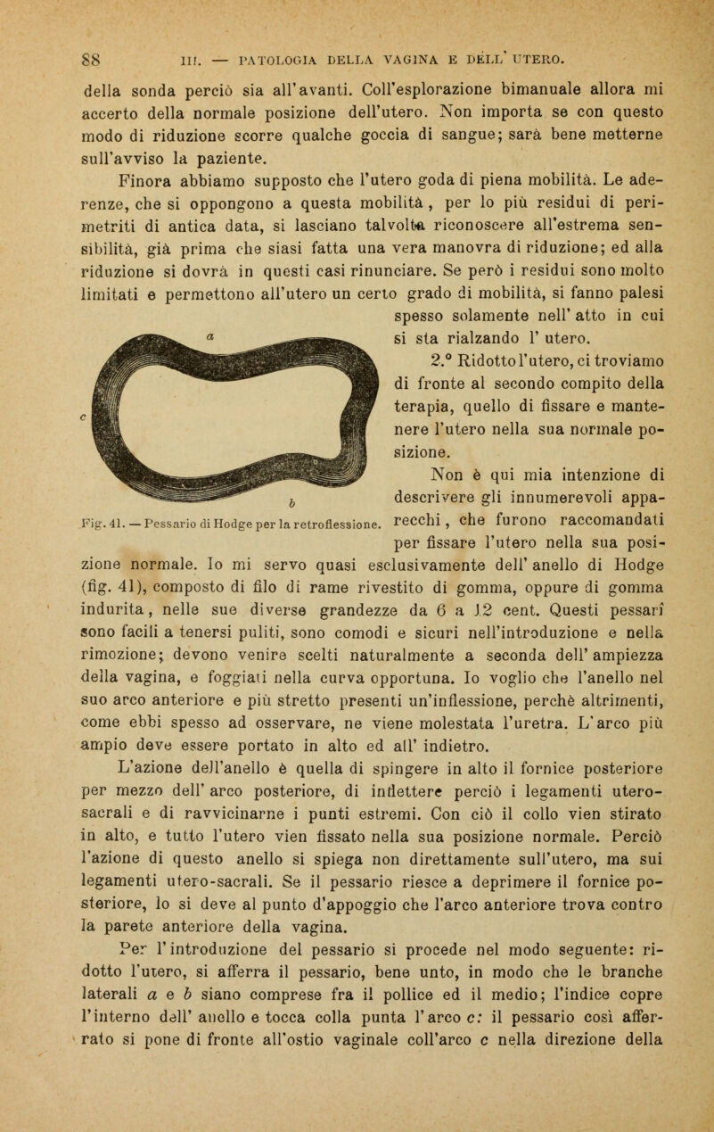 della sonda perciò sia all'avariti. Coll'esplorazione bimanuale allora mi accerto della normale posizione dell'utero. Non importa se con questo modo di riduzione scorre qualche goccia di sangue; sarà bene metterne sull'avviso la paziente. Finora abbiamo supposto che l'utero goda di piena mobilità. Le ade- renze, che si oppongono a questa mobilità , per lo più residui di peri- metriti di antica data, si lasciano talvolta riconoscere all'estrema sen- sibilità, già prima che siasi fatta una vera manovra di riduzione; ed alla riduzione si dovrà in questi casi rinunciare. Se però i residui sono molto limitati e permettono all'utero un certo grado di mobilità, si fanno palesi spesso solamente nell' atto in cui si sta rialzando 1' utero. 2.° Ridotto l'utero, ci troviamo di fronte al secondo compito della terapia, quello di fissare e mante- nere l'utero nella sua normale po- sizione. Non è qui mia intenzione di b descrivere gli innumerevoli appa- Fig. 4L -Pessario di Hodge per la retroflessione, recchi , che furono raccomandati per fissare l'utero nella sua posi- zione normale. Io mi servo quasi esclusivamente dell' anello di Hodge (fìg. 41), composto di filo di rame rivestito di gomma, oppure di gomma indurita, nelle sue diverse grandezze da 6 a J.2 cent. Questi pessari sono facili a tenersi puliti, sono comodi e sicuri nell'introduzione e nella rimozione; devono venire scelti naturalmente a seconda dell'ampiezza della vagina, e foggiati nella curva opportuna. Io voglio che l'anello nel suo arco anteriore e più stretto presenti un'inflessione, perchè altrimenti, come ebbi spesso ad osservare, ne viene molestata l'uretra. L'arco più ampio deve essere portato in alto ed ali' indietro. L'azione dell'anello è quella di spingere in alto il fornice posteriore per mezzo dell' arco posteriore, di inflettere perciò i legamenti utero- sacrali e di ravvicinarne i punti estremi. Con ciò il collo vien stirato in alto, e tutto l'utero vien fissato nella sua posizione normale. Perciò l'azione di questo anello si spiega non direttamente sull'utero, ma sui legamenti utero-sacrali. Se il pessario riesce a deprimere il fornice po- steriore, lo si deve al punto d'appoggio che l'arco anteriore trova contro la parete anteriore della vagina. Per l'introduzione del pessario si procede nel modo seguente: ri- dotto l'utero, si afferra il pessario, bene unto, in modo che le branche laterali a e b siano comprese fra il pollice ed il medio; l'indice copre l'interno dell'anello e tocca colla punta l'arco e: il pessario così affer- rato si pone di fronte all'ostio vaginale coll'arco e nella direzione della