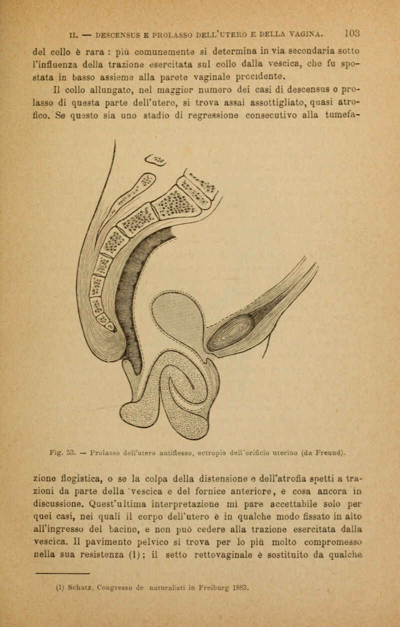 del collo è rara : più comunemente si determina in via secondaria sotto l'influenza della trazione esercitata sul collo dalla vescica, che fu spo- stata in basso assieme alla parete vaginale precidente. Il collo allungato, nel maggior numero dei casi di descensus o pro- lasso di questa parte dell'utero, si trova assai assottigliato, quasi atro- fico. Se questo sia uno stadio di regressione consecutivo alla tumefa- Fig. 53. — Prolasso dell'utero autiflesso, ectropio dell'orificio uterino (da Freund). zione flogistica, o se la colpa della distensione e dell'atrofia snetti a tra- zioni da parte della vescica e del fornice anteriore, e cosa ancora io discussione. Quest'ultima interpretazione mi pare accettabile solo per quei casi, nei quali il corpo dell'utero è in qualche modo fissato in alto all'ingresso del bacino, e non può cedere alla trazione esercitata dalla vescica. 11 pavimento pelvico si trova per lo più molto compronic nella sua resistenza (1); il setto rettovaginale è sostituito da qualche (1) Schatz. Congresso de naturalisti in Freiburg 1SS3.