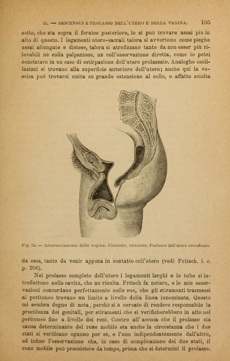 setto, che sta sopra il fornice posteriore, lo si può trovare assai più in alto di questo. I legamenti utero-sacrali talora si avvertono come pieghe assai allungate e distese, talora si atrofizzano tanto da non esser più ri- levabili né colla palpazione, né coll'osservazione diretta, come io potei constatare in un caso di estirpazione dell'utero prolassato. Analoghe oscil- lazioni si trovano alla superficie anteriore dell'utero; anche qui la ve- scica può trovarsi unita su grande estensione al collo, o affatto sciolta Fìet. 54. — Arrovesciamento della vagina. Cistocele, rettocele. Prolasso dell'utero retroflesso. -da essa, tanto da venir appana in contatto coll'utero (vedi Fritsch. 1. e. p. 206). Nel prolasso completo dell'utero i legamenti larghi e le tube si in- troflettono nella cavità, che ne risulta. Fritsch fa notare, e le mie osser- vazioni concordano perfettamente colle sue, che gli stiramenti trasmessi al peritoneo trovano un limite a livello della linea innominata. Questo mi sembra degno di nota, perchè si è cercato di rendere responsabile la procidenza dei genitali, per stiramenti che si verificherebbero in alto nel peritoneo fino a livello dei reni. Contro all' accusa che il prolasso sia causa determinante del reae mobile sta anche la circostanza che i due stati si verificano ognuno per se, e l'uno indipendentemente dall'altro, ed infine l'osservazione che, in caso di complicazione dei due stati, il rene mobile può preesistere da tempo, prima che si determini il prolasso.