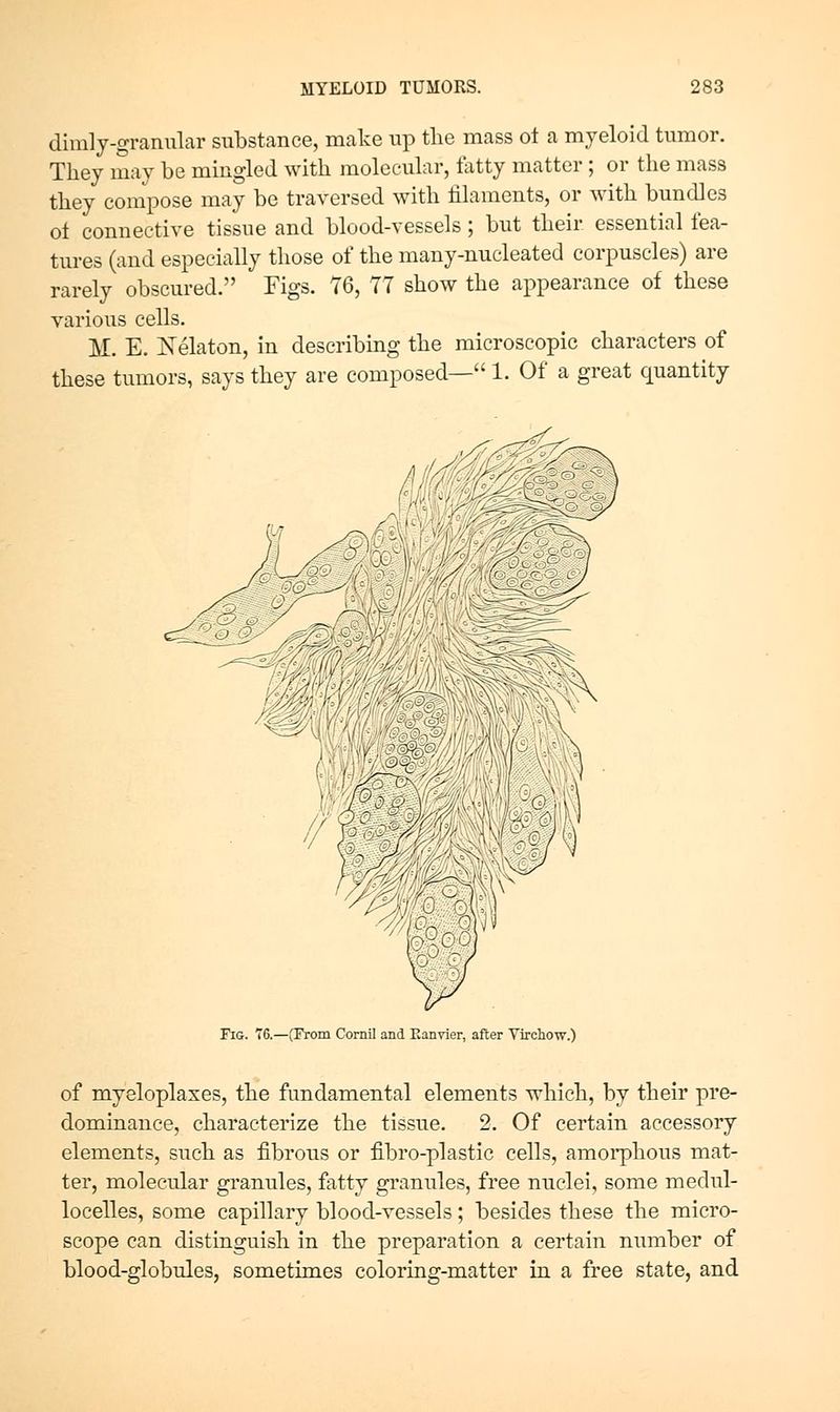 dimlj-granular substance, make up tlie mass ot a myeloid tumor. Thej may be mingled with molecular, fatty matter ; or the mass they compose may be traversed with filaments, or with bundles o± connective tissue and blood-vessels; but their essential fea- tures (and especially those of the many-nucleated corpuscles) are rarely obscured. Figs. 76, 77 show the appearance of these various cells. M. E. Xelaton, in describmg the microscopic characters of these tumors, says they are composed— 1. Of a great quantity Fig. T6.—(From Cornil and Eanvier, after Virchow.) of myeloplaxes, the fundamental elements which, by their pre- dominance, characterize the tissue. 2. Of certain accessory elements, such as fibrous or fibro-plastic cells, amoi'phous mat- ter, molecular granules, fatty granules, free nuclei, some medul- locelles, some capillary blood-vessels; besides these the micro- scope can distinguish in the preparation a certain number of blood-globules, sometimes coloring-matter in a free state, and