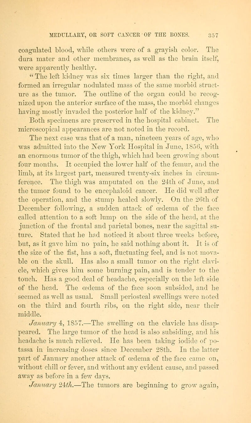 coagulated blood, M'liile others were of a grajisli color. The dui'a mater and other membranes, as well as the brain itself, were apparently healthy, The left kidney was six times larger than the right, and formed an irregular nodulated mass of the same morbid struct- ure as the tumor. The outline of the oro-an could be recoo- nizecl upon the anterior surface of the mass, the morbid changes haying mostly inyaded the posterior half of the kidney. Both specimens are preseryecl in the hospital cabinet. The microscopical appearances are not noted in the record. The next case was that of a man, nineteen years of age, who was admitted into the ISTew York Hospital in June, 1856, with an enormous tumor of the thigh, which had been growing about four months. It occupied the lower half of the femur, and the limb, at its largest part, measured twenty-six inches in circum- fererice. The thigh was amputated on the Slth of June, and the tumor found to be encephaloid cancer. He did well after the operation, and the stump healed slowly. On the 26th of December following, a sudden attack of oedema of the face called attention to a soft lump on the side of the head, at the junction of the frontal and parietal bones, near the sagittal su- ture. Stated that he had noticed it about thi'ee weeks before, but, as it gaye him no pain, he said nothing about it. It is of the size of the fist, has a soft, fluctuating feel, and is not moya- ble on the skull. Has also a small tumor on the right clayi- cle, which giyes him some burning pain, and is tender to the touch. Has a good deal of headache, especially on the left side of the head. The oedema of the face soon subsided, and he seemed as well as usual. Small periosteal swellings were noted on the third and fourth ribs, on the right side, near their middle. January 4, 1857.—The swellmg on the clayicle has disap- peared. The large tumor of the head is also subsiding, and his headache is much relieyed. He has been taking iodide of po- tassa in increasing doses since December 28th. In the latter part of January another attack of oedema of the face came on, without chill or feyer, and without any eyident cause, and passed away as before in a few days. Jamiary 24:th.—The tumors are beo-innino; to m-ow ao:ain,