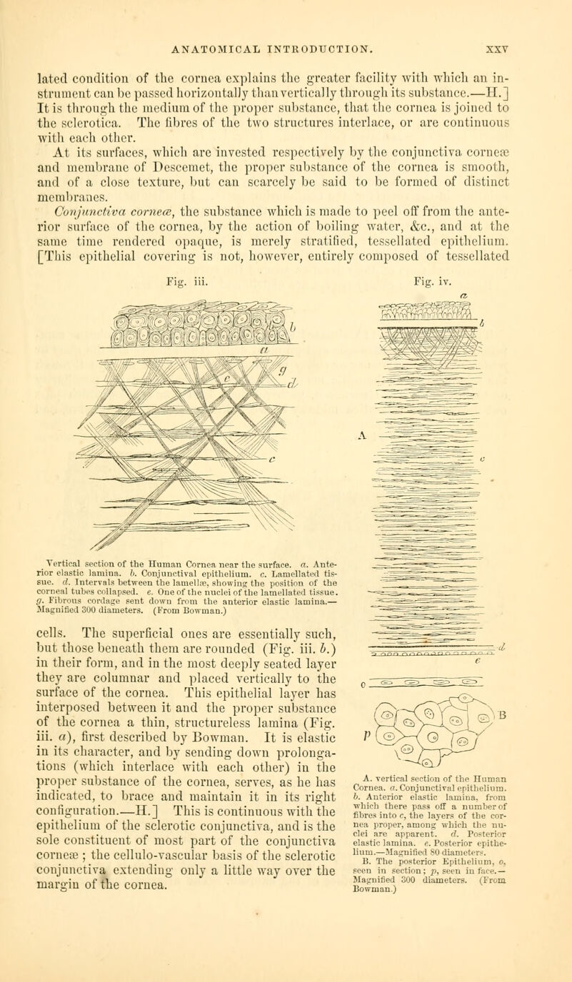 lated condition of the cornea explains the greater facility with which an in- strument can be passed horizontally than vertically through its substance.—H.] It is through the medium of the proper substance, that the cornea is joined to the sclerotica. The fibres of the two structures interlace, or are continuous with each other. At its surfaces, which arc invested respectively by the conjunctiva corneas and membrane of Descemet, the proper substance of the cornea is smooth, and of a close texture, but can scarcely be said to be formed of distinct membranes. Conjunctiva cornecB, the substance which is made to peel off from the ante- rior surface of the cornea, by the action of boiling water, &c., and at the same time rendered opaque, is merely stratified, tessellated epithelium. [This epithelial covering is not, however, entirely composed of tessellated Fia;. iii. _ Vertical section of the Human Cornea near the surface, a. Ante- rior elastic lamina, h. Conjunctival epithelium, c. LameUated tis- sue, d. Intervals between the lamellne, showing the position of the corneal tubes collapsed, e. One of the nuclei of the lamellated tissue. g. Fibrous cordage sent down from the anterior elastic lamina.— Magnified 300 diameters. (From Bowman.) cells. The superficial ones are essentially such, but those beneath them are rounded (Fig. iii. h.) in their form, and in the most deeply seated layer they are columnar and placed vertically to the surface of the cornea. This epithelial layer has interposed between it and the proper substance of the cornea a thin, structureless lamina (Fig. iii. a), first described by Bowman. It is elastic in its character, and by sending down prolonga- tions (which interlace with each other) in the proper substance of the cornea, serves, as he has indicated, to brace and maintain it in its right configuration—H.] This is continuous with the epithelium of the sclerotic conjunctiva, and is the sole constituent of most part of the conjunctiva cornece ; the cellulo-vascular basis of the sclerotic conjunctiva extending only a little way over the margin of the cornea. Fig. iv. A. vertical section of the Human Cornea, a. Conjunctival epithelium. h. Anterior elastic lamina, from which there pass off a number of fibres into c, the layers of the cor- nea proper, among which the nu- clei are apparent. d. Posterior elastic lamina. «. Posterior epithe- lium.—Magnified 80 diameters. B. The posterior Epithelium, o. seen in section; ^, seen in face.— Magnified 300 diameters. (From Bowman.)