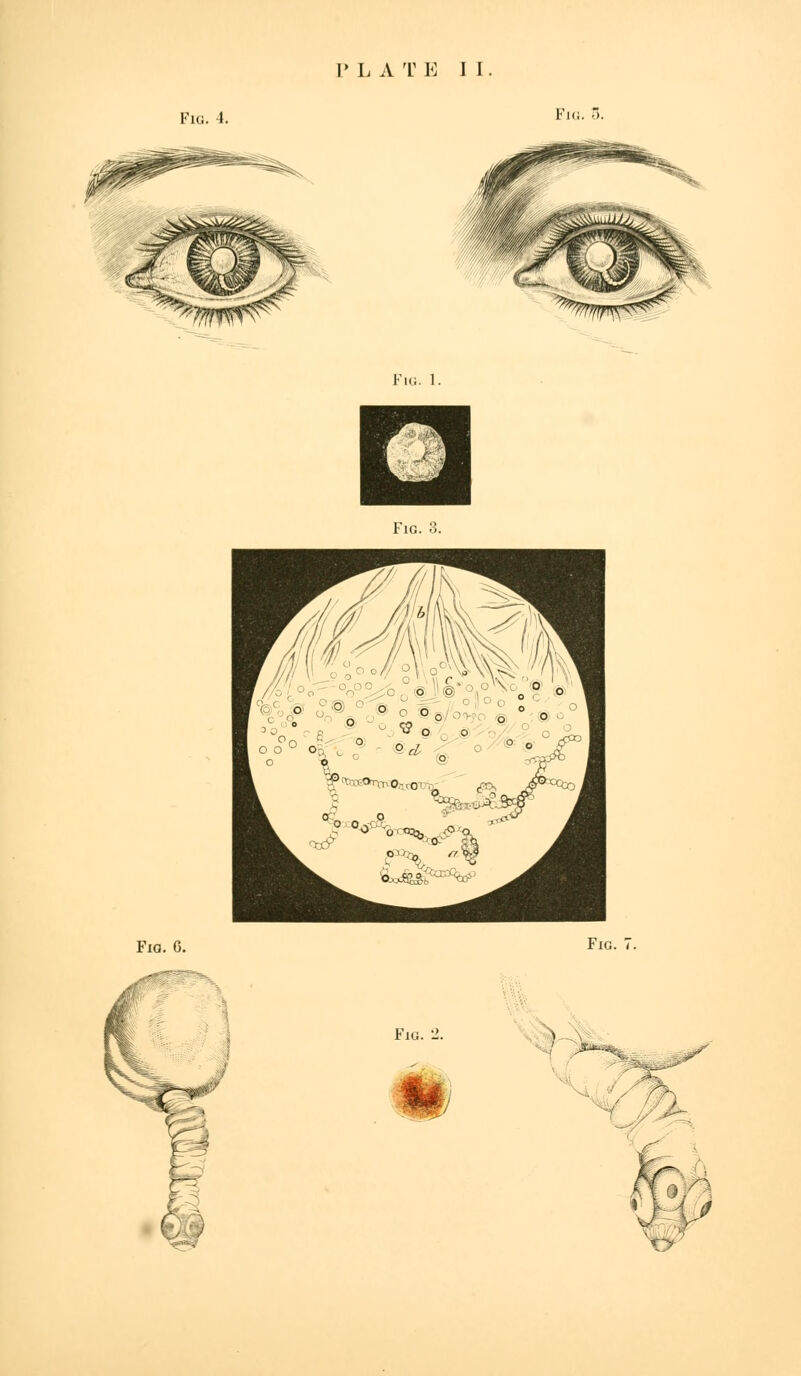 I? L A T E II. Fio. 4. Fiti. 5. Fig. 1. Fig. 3. Fig. 6. Fig. Fig. 2.