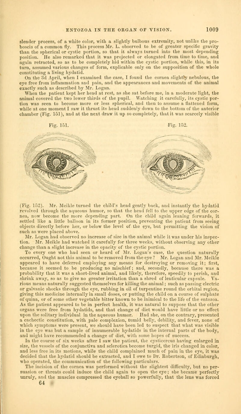 slender process, of a white color, with a slightly bulbous extremity, not unlike the pro- boscis of a common fly. This process Mr. L. observed to be of greater specific gravity than the spherical or cystic portion, so that it always turned into the most depending position. He also remarlied that it was projected or elongated from time to time, and again retracted, so as to be completely liid within the cystic portion, Avhile this, in its turn, assumed various changes of form, explicable only on the supposition of the whole constituting a living hydatid. On the 3d April, when I examined the case, I found the cornea slightly nebulous, the eye free from inflammation and pain, and the appearances and movements of the animal exactly such as described by Mr. Logan. When the patient kept her head at rest, as she sat before me, in a moderate light, the animal covered the two lower tliirds of the pupil. Watching it carefully, its cystic por- tion was seen to become more or less spherical, and then to assume a flattened form, while at one moment I saw it thrust its head suddenly down to the bottom of the anterior chamber (Fig. 151), and at the next draw it up so completely, that it was scarcely visible Fig. 151. Fiff. 152. (Fig. 152). Mr. Meikle turned the child's head gently back, and instantly the hydatid revolved through the aqueous humoi, so that the head fell to the upper edge of the cor- nea, now become the more depending jDart. On the child again leaning forwards, it settled like a little balloon in its former i^osition, preventing the patient from seeing objects directly before her, or below the level of the eye, but jjermitting the vision of such as were placed above. Mr. Logan had observed no increase of size in the animal while it was under his inspec- tion. Mr. Meikle had watched it carefully for three weeks, without observing any other change than a slight increase in the opacity of the cystic portion. To every one who had seen or heard of Mr. Logan's case, the question naturally occurred. Ought not this animal to be removed from the eye ? Mr. Logan and Mr. Meikle appeared to have deferred employing any means for destroying or removing it; first, because it seemed to be producing no mischief; and, secondly, because there was a probability that it was a short-lived animal, and likely, therefore, speedily to perish, and shrink away, so as to give no greater irritation than a shred of lenticular capsule. Va- rious means naturallj' suggested themselves for killing the animal; such as passing electric or galvanic shocks through the eye, rubbing in oil of turpentine round the orbital region, giving this medicine internally in small doses, or iiutting the child on a course of sulphate of quina, or of some other vegetable bitter known to be inimical to the life of the entozoa. As the patient appeared to be in perfect health, it was natural to suppose that the other organs were free from hydatids, and that change of diet would have little or no effect upon the solitary individual in the aqueous humor. Had she, on the contrary, presented a cachectic constitution, with pale complexion, tumid belly, debility, and fever, none of which symptoms were present, we should have been led to suspect that what was visible in the eye was but a sample of innumerable hydatids in the internal parts of the body, and might have recommended a change of diet, with some hopes of success. In the course of six weeks after I saw the patient, the cysticercus having enlarged in size, the vessels of the conjunctiva and sclerotica become turgid, the iris changed in color, and less free in its motions, while the child complained much of pain in the eye, it was decided that the hydatid should be extracted, and I owe to Dr. Robertson, of Edinburgh, who operated, the communication of the following particulars. The incision of the cornea was performed without the slightest difliculty, but no per- suasion or threats could induce the child again to open the eye; she became perfectly unruly, and the muscles compressed the eyeball so powerfully, that the lens was forced 64