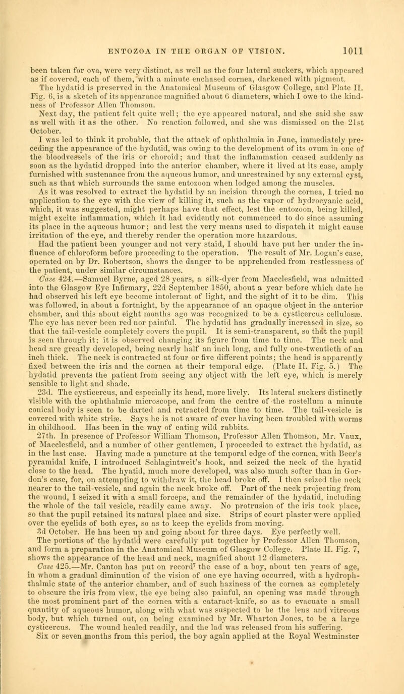 been taken for ova, were very distinct, as well as the four lateral suckers, which appeared as if covered, each of them, witli a minute enchased cornea, darkened witli pigment. The liydatiil is preserved in the Aiiatoniical Museum of Glasgow College, and Plate IL. Fig. (J, is a sketcii of its appearance magnified about 0 diameters, which I owe to tlie kind- ness of Professor Allen Thomson. Next day, the patient felt (piite well; the eye appeared natural, and she said she saw as well witli it as the other. No reaction followed, and she was dismissed on the 21st October. I was led to think it probable, that the attack of ophthalmia in June, immediately pre- ceding the appearance of the hydatid, was owing to the development of its ovum in one of the bloodvessels of the iris or choroid; and tlnit the inflammation ceased suddenly as soon as the hydatid dropped into the anterior chamber, where it lived at its ease, amply furnished with sustenance from the atjuoous humor, and unrestrained by any extei'nal cyst, such as that which surrounds the same entozoon when lodged among the muscles. vVs it was resolved to extract the hydatid by an incision througli the cornea, 1 tried no application to the eye with the view of killing it, such as the vapor of hydrocyanic acid, which, it was suggested, miglit perhaps have that effect, lest the entozoon, being killed, might excite inflammation, which it had evidently not commence<l to do since assuming its place in the aqueous humor; and lest the very means used to dispatch it miglit cause irritation of tlie eye, and thereby render the operation more hazardous. Had the patient been younger and not very staid, I should have put her under the in- fluence of chloroform before proceeding to the operation. The result of Mr. Logan's case, operated on by Dr. Robertson, shows the danger to be apprehended from restlessness of the patient, under similar circumstances. Case 424.—Samuel Byrne, aged 28 years, a silk-dyer from Macclesfield, was admitted into the Glasgow Eye Infirmary, 22d September 1850, about a year before which date ho bad obsei'ved his left eye become intolerant of light, and the sight of it to be dim. This was followed, in about a fortnight, by the appearance of an opaque object in the anterior chamber, and this about eight months ago was recognized to be a cysticercus cellulosse. The eye has never been red nor painful. The hydatid has gradually increased in size, so that the tail-vesicle completely covers the pupil. It is semi-transparent, so that the pupil is seen through it; it is observed changing its figure from time to time. The neck and head are gi'eatly developed, being nearly half an inch long, and fully one-twentieth of an inch thick. The neck is contracted at four or five different points; the head is apparently fixed between the iris and the cornea at their temporal edge. (Plate II. Fig. 5.) The hydatid prevents the patient from seeing any object with the left eye, which is merely sensible to light and shade. 23d. The cysticercus, and especially its head, more lively. Its lateral suckers distinctly visible with the ophthalmic microscope, and from the centre of the rostellum a minute conical body is seen to be darted and retracted from time to time. The tail-vesicle is covered with white strife. Says he is not aware of ever having been troubled with worms in childhood. Has been in the way of eating wild rabbits. 27th. In presence of Professor William Thomson, Professor Allen Thomson, Mr. Yaux, of ^lacclcsfield, and a number of other gentlemen, I proceeded to extract the hydatid, as in the last case. Having made a puncture at the temporal edge of the cornea, with Beer's pyramidal knife, I introduced Schlagintweit's hook, and seized the neck of the hyatid close to the head. The hyatid, much more developed, was also much softer than in Gor- don's case, for, on attempting to withdraw it, the head broke off. I then seized the neck nearer to the tail-vesicle, and again the neck broke off. Part of the neck projecting from the wound, I seized it with a small forceps, and the remainder of the hydatid, including the whole of the tail vesicle, readily came away. No protrusion of the iris took place, so that the pupil retained its natviral place and size. Strips of court plaster were applied over the eyelids of both eyes, so as to keep the eyelids from moving. 3d October. He has been up and going about for three days. Eye perfectly well. The portions of the hydatid were carefully put together by Professor Allen Thomson, and form a preparation in the Anatomical Jluseum of Glasgow College. Plate II. Fig. 7, shows the appearance of the head and neck, magnified about 12 diameters. Case 425.—]Mr. Canton has put on record' the case of a boy, about ten years of age, in whom a gradual diminution of the vision of one eye having occurred, with a hydroph- thalmic state of the anterior chamber, and of such haziness of the cornea as completely to obscure the iris from view, the eye being also painful, an opening was made through the most prominent part of the cornea with a cataract-knife, so as to evacuate a small quantity of aqueous humor, along with what was suspected to be the lens and vitreous body, but which turned out, on being examined by Mr. Wharton Jones, to be a large cysticercus. The wound healed readily, and the lad was released from his suffering. Six or seven months from this period, the boy again applied at the Royal Westminster
