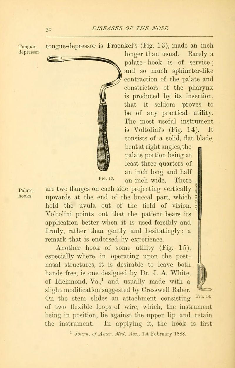 Tongue- depressor Palate - hooks tongue-depressor is Fraenkel's (Fig. 13), made an inch longer than usual. Earely a palate - hook is of service ; and so much sphincter-like contraction of the palate and constrictors of the pharynx is produced by its insertion, that it seldom proves to be of any practical utility. The most useful instrument is Voltolini's (Fig. 14). It consists of a solid, flat blade, bent at right angles, the palate portion being at least three-quarters of an inch long and half p IG'13- an inch wide. There are two flanges on each side projecting vertically l\ upwards at the end of the buccal part, which l\ hold the uvula out of the field of vision. Voltolini points out that the patient bears its application better when it is used forcibly and firmly, rather than gently and hesitatingly; a remark that is endorsed by experience. Another hook of some utility (Fig. 15), especially where, in operating upon the post- nasal structures, it is desirable to leave both hands free, is one designed by Dr. J. A. White, of Richmond, Va.,1 and usually made with a slight modification suggested by Cresswell Baber. On the stem slides an attachment consisting F''14' of two flexible loops of wire, which, the instrument being in position, lie against the upper lip and retain the instrument. In applying it, the hook is first 1 Journ, of Amer. Med. Ass., 1st February 1888.