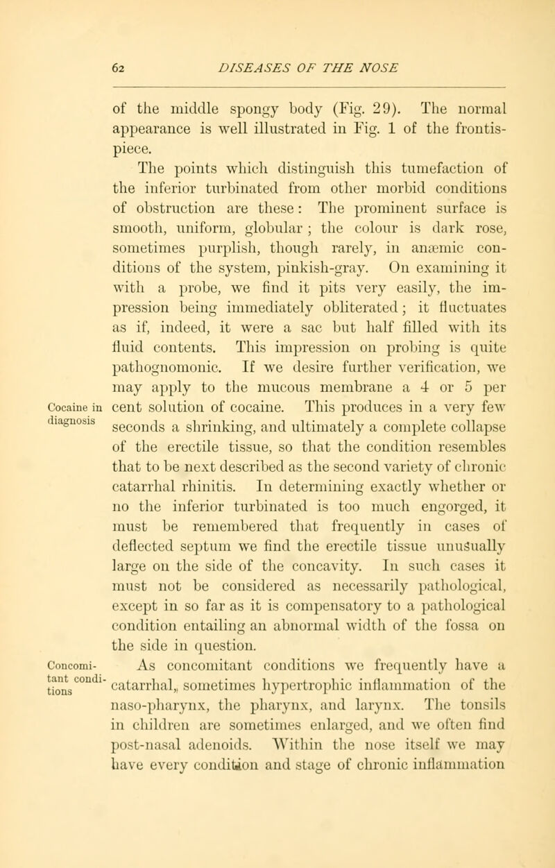 of the middle spongy body (Fig. 29). The normal appearance is well illustrated in Fig. 1 of the frontis- piece. The points which distinguish this tumefaction of the inferior turbinated from other morbid conditions of obstruction are these: The prominent surface is smooth, uniform, globular ; the colour is dark rose, sometimes purplish, though rarely, in anaemic con- ditions of the system, pinkish-gray. On examining it with a probe, we find it pits very easily, the im- pression being immediately obliterated; it fluctuates as if, indeed, it were a sac but half filled with its fluid contents. This impression on probing is quite pathognomonic. If we desire further verification, we may apply to the mucous membrane a 4 or 5 per Cocaine in cent solution of cocaine. This produces in a very few lagnosis seconcis a shrinking, and ultimately a complete collapse of the erectile tissue, so that the condition resembles that to be next described as the second variety of chronic catarrhal rhinitis. In determining exactly whether or no the inferior turbinated is too much engorged, it must be remembered that frequently in cases of deflected septum we find the erectile tissue unusually large on the side of the concavity. In such cases it must not be considered as necessarily pathological, except in so far as it is compensatory to a pathological condition entailing an abnormal width of the fossa on the side in question. Concomi- As concomitant conditions we frequently have a tionsC°n  catarrhal,, sometimes hypertrophic inflammation of the naso-pharynx, the pharynx, and larynx. The tonsils in children are sometimes enlarged, and we often find post-nasal adenoids. Within the nose itself we may have every condition and stage of chronic inflammation