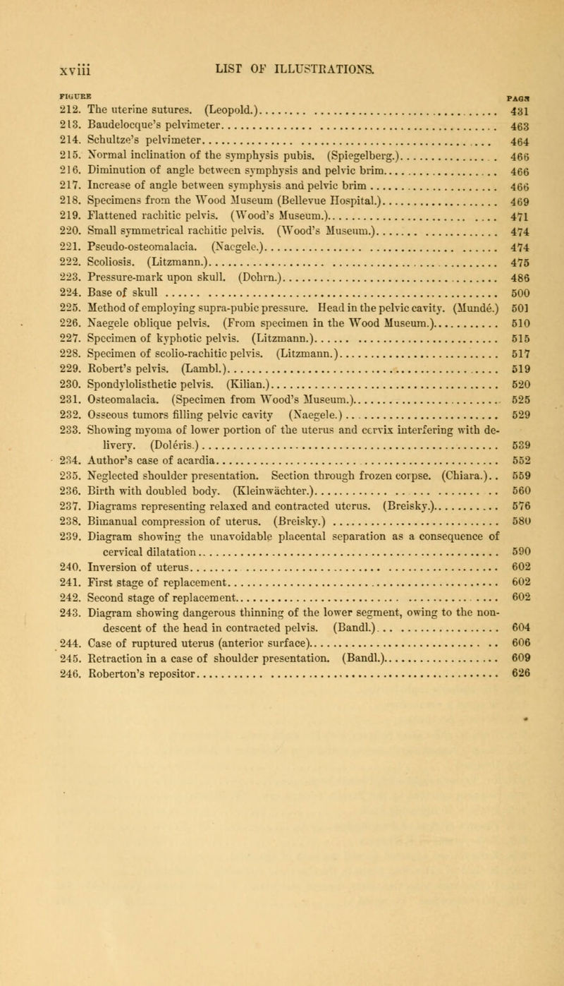 FIGCBE PAG Jl 212. The uterine sutures. (Leopold.) 431 213. Baudelocque's pelvimeter 463 214. Schultze's pelvimeter 464 215. Xormal inclination of the symphysis pubis. (Spiegelberg.) . 466 216. Diminution of angle between symphysis and pelvic brim 466 217. Increase of angle between symphysis and pelvic brim 466 218. Specimens from the Wood Museum (Bellevue Hospital.) 469 219. Flattened rachitic pelvis. (Wood's Museum.) 471 220. Small symmetrical rachitic pelvis. (Wood's Museum.) 474 221. Pseudo-osteomalacia. (Xaegele.) 474 222. Scoliosis. (Litzmann.) 475 223. Pressure-mark upon skull. (Dohrn.) 486 224. Base of skull 500 225. Method of employing supra-pubic pressure. Head in the pelvic cavity. (Munde.) 501 226. Naegele oblique pelvis. (From specimen in the Wood Museum.) 510 227. Specimen of kyphotic pelvis. (Litzmann.) 515 228. Specimen of scolio-rachitic pelvis. (Litzmann.) 517 229. Robert's pelvis. (Lambl.) 519 230. Spondylolisthetic pelvis. (Kilian.) 520 231. Osteomalacia. (Specimen from Wood's Museum.) 525 232. Osseous tumors filling pelvic cavity (Xaegele.) 529 233. Showing myoma of lower portion of the uterus and cervix interfering with de- livery. (Doleris.) 539 234. Author's case of acardia 552 235. Neglected shoulder presentation. Section through frozen corpse. (Chiara.).. 559 236. Birth with doubled body. (Kleinwachter.) 560 237. Diagrams representing relaxed and contracted uterus. (Breisky.) 576 238. Bimanual compression of uterus. (Breisky.) 580 239. Diagram showing the unavoidable placental separation as a consequence of cervical dilatation 590 240. Inversion of uterus 602 241. First stage of replacement 602 242. Second stage of replacement .... 602 243. Diagram showing dangerous thinning of the lower segment, owing to the non- descent of the head in contracted pelvis. (Bandl.) 604 244. Case of ruptured uterus (anterior surface) 606 245. Retraction in a case of shoulder presentation. (Bandl.) 609 246. Roberton's repositor 626