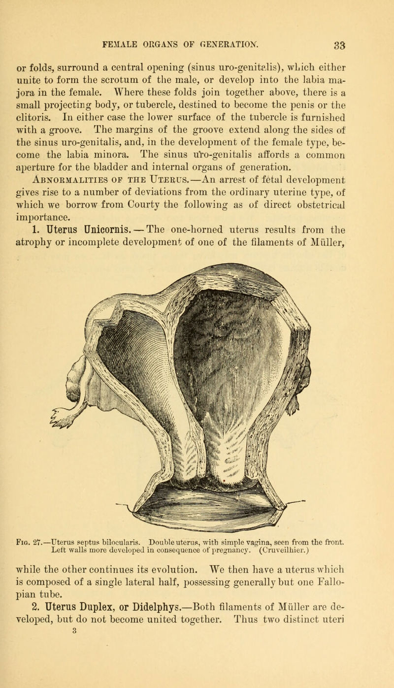 or folds, surround a central opening (sinus uro-genitalis), which either unite to form the scrotum of the male, or develop into the labia ma- jora in the female. Where these folds join together above, there is a small projecting body, or tubercle, destined to become the penis or the clitoris. In either case the lower surface of the tubercle is furnished with a groove. The margins of the groove extend along the sides of the sinus uro-genitalis, and, in the development of the female type, be- come the labia minora. The sinus uro-genitalis affords a common aperture for the bladder and internal organs of generation. Abnormalities of the Uterus.—An arrest of fetal development gives rise to a number of deviations from the ordinary uterine type, of which we borrow from Courty the following as of direct obstetrical importance. 1. Uterus Unicornis. — The one-horned uterus results from the atrophy or incomplete development of one of the filaments of Miiller, Fig. 27.—Uterus septus bilocularis. Double uterus, with simple vagina, seen from the front. Left walls more developed in consequence of pregnancy. (Cruveilhier.) while the other continues its evolution. We then have a uterus which is composed of a single lateral half, possessing generally but one Fallo- pian tube. 2. Uterus Duplex, or Didelphys.—Both filaments of Miiller are de- veloped, but do not become united together. Thus two distinct uteri 3