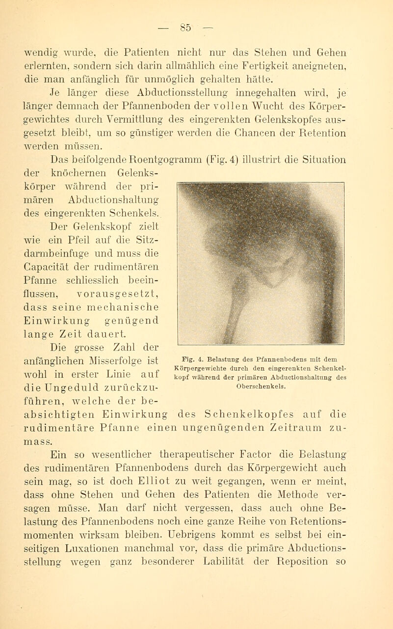 wendig wurde, die Patienten nicht nur das Stehen und Gehen erlernten, sondern sich darin allmählich eine Fertigkeit aneigneten, die man anfänglich für unmöglich gehalten hätte. Je länger diese Abductionsstellung innegehalten wird, je länger demnach der Pfannenboden der vollen Wucht des Körper- gewichtes durch Vermittlung des eingerenkten Gelenkskopfes aus- gesetzt bleibt, um so günstiger werden die Chancen der Retention werden müssen. Das beifolgende Roentgogramm (Fig. 4) illustrirt die Situation der knöchernen Gelenks- körper während der pri- mären Abductionshaltung des eingerenkten Schenkels. Der Gelenkskopf zielt wie ein Pfeil auf die Sitz- darmbeinfuge und muss die Capacität der rudimentären Pfanne schliesslich beein- flussen, vorausgesetzt, dass seine mechanische Einwirkung genügend lange Zeit dauert. Die grosse Zahl der anfänglichen Misserfolge ist wohl in erster Linie auf die Ungeduld zurückzu- führen, welche der be- absichtigten Einwirkung des Schenkelkopfes auf die rudimentäre Pfanne einen ungenügenden Zeitraum zu- mass. Ein so wesentlicher therapeutischer Factor die Belastung des rudimentären Pfannenbodens durch das Körpergewicht auch sein mag, so ist doch Elliot zu weit gegangen, wenn er meint, dass ohne Stehen und Gehen des Patienten die Methode ver- sagen müsse. Man darf nicht vergessen, dass auch ohne Be- lastung des Pfannenbodens noch eine ganze Reihe von Retentions- momenten wirksam bleiben. Uebrigens kommt es selbst bei ein- seitigen Luxationen manchmal vor, dass die primäre Abductions- stellung wegen ganz besonderer Labilität der Reposition so Fig. 4. Belastung des Pfannenbodens mit dem Körpergewichte durch den eingerenkten Sehenkel- kopf während der primären Abductionshaltung des Oberschenkels.