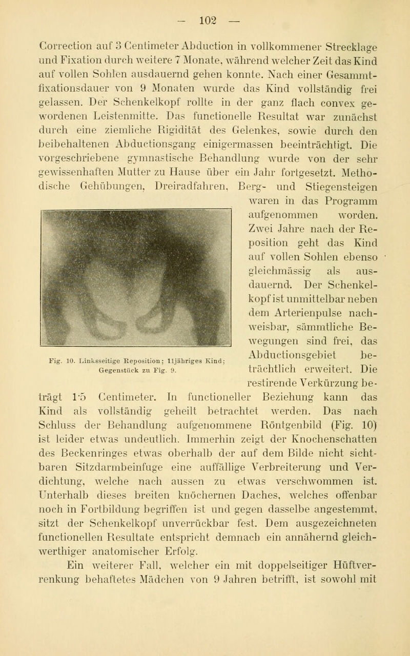 Correction auf 3 Centimeter Abduction in vollkommener Strecklage und Fixation durch weitere 7 Monate, während welcher Zeit das Kind auf vollen Sohlen ausdauernd gehen konnte. Nach einer Gesammt- fixationsdauer von 9 Monaten wurde das Kind vollständig frei gelassen. Der Schenkelkopf rollte in der ganz flach convex ge- wordenen Leistenmitte. Das functionelle Resultat war zunächst durch eine ziemliche Rigidität des Gelenkes, sowie durch den beibehaltenen Abductionsgang einigermassen beeinträchtigt. Die vorgeschriebene gymnastische Behandlung wurde von der sehr gewissenhaften Mutter zu Hause über ein Jahr fortgesetzt. Metho- dische Gehübungen, Dreiradfahren. Berg- und Stiegensteigen waren in das Programm aufgenommen worden. Zwei Jahre nach der Re- position geht das Kind auf vollen Sohlen ebenso gleichmässig als aus- dauernd. Der Schenkel- kopfist unmittelbar neben dem Arterienpulse nach- weisbar, sämmtliche Be- wegungen sind frei, das Abductionsgebiet be- trächtlich erweitert. Die restirende Verkürzung be- trägt 1*5 Centimeter. In functioneller Beziehung kann das Kind als vollständig geheilt betrachtet werden. Das nach Schluss der Behandlung aufgenommene Röntgenbild (Fig. 10) ist leider etwas undeutlich. Immerhin zeigt der Knochenschatten des Beckenringes etwas oberhalb der auf dem Bilde nicht sicht- baren Sitzdarmbeinfuge eine auffällige Verbreiterung und Ver- dichtung, welche nach aussen zu etwas verschwommen ist. Unterhalb dieses breiten knöchernen Daches, welches offenbar noch in Fortbildung begriffen ist und gegen dasselbe angestemmt, sitzt der Schenkelkopf unverrückbar fest. Dem ausgezeichneten functionellen Resultate entspricht demnach ein annähernd gleich- werthiger anatomischer Erfolg. Ein weiterer Fall, welcher ein mit doppelseitiger Hüftver- renkung behaftetes Mädchen von 9 Jahren betrifft, ist sowohl mit Fig. 10. Linksseitige Reposition; lljähriges Kind: Gegenstück zu Fig. 9.