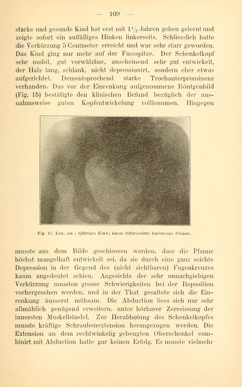 starke und gesunde Kind hat erst mit V/2 Jahren gehen gelernt und zeigte sofort ein auffälliges Hinken linkerseits. Schliesslich hatte die Verkürzung 5 Centmeter erreicht und war sehr starr geworden. Das Kind ging nur mehr auf der Fussspitze. Der Schenkelkopf sehr mobil, gut vorwälzbar, anscheinend sehr gut entwickelt, der Hals lang, schlank, nicht depressionirt, sondern eher etwas aufgerichtet. Dementsprechend starke Trochanterprominenz verhanden. Das vor der Einrenkung aufgenommene Röntgenbild (Fig. 15) bestätigte den klinischen Befund bezüglich der aus- nahmsweise guten Kopfentwickelung vollkommen. Hingegen Fig. 15. Lux. sin.; öjäuriges Kind; kaum differenzirte knöcherne Pfanne. musste aus dem Bilde geschlossen werden, dass die Pfanne höchst mangelhaft entwickelt sei, da sie durch eine ganz seichte Depression in der Gegend des (nicht sichtbaren) Fugenkreuzes kaum angedeutet schien. Angesichts der sehr unnachgiebigen Verkürzung mussten grosse Schwierigkeiten bei der Reposition vorhergesehen werden, und in der That gesaltete sich die Ein- renkung äusserst mühsam. Die Abduction Hess sich nur sehr allmählich genügend erweitern, unter hörbarer Zerreissung der innersten Muskelbündel. Zur Herabholung des Schenkelkopfes musste kräftige Schraubenextension herangezogen werden. Die Extension an dem rechtwinkelig gebeugten Oberschenkel com- binirt mit Abduction hatte gar keinen Erfolg. Es musste vielmehr
