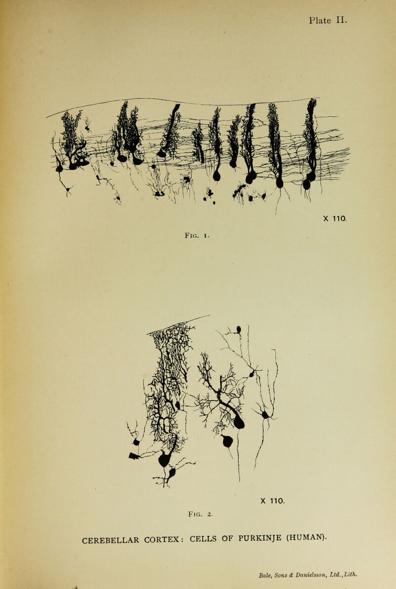 X 110. Fig. i. X 110. Fig. 2. CEREBELLAR CORTEX: CELLS OF PURKINJE (HUMAN).