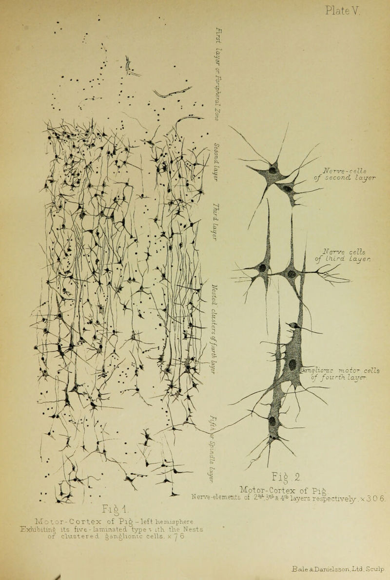 Plate V. JTer-ve - c ills of second, layer Nerve cells of third layer. ~ iocO1- cells f fourth layer. FiM. Yi\ 2 o MoioT-CoTtex of Pi* Nerve-dements al 2,* 3*s r- layers respectively. v 3 0 6. . r-Cortex of Pl&-left lieituspl its five type-* Lth the N cluster ed ci Lis ■ 7 5 Pale ^iJamelsson.Ltd, Sculp