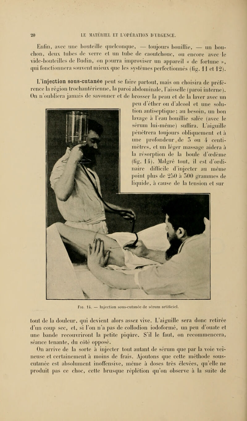 Enfin, avec une bouteille quelconque, — toujours bouillie, — un bou- chon, deux luîtes de verre et on tube de caoutchouc, ou encore avec le vide-bouteilles de liudin, on pourra improviser un appareil « de fortune ». qui fonctionnera souvent mieux que les systèmes perfectionnés (fig. Il et lv2). L'injection sous-cutanée peut se faire partout, mais on choisira de préfé- rence la région trochantérienne, la paroi abdominale, l'aisselle (paroi interne). On n'oubliera jamais de savonner cl de brosser la peau et de la laver avec un peu d'éther ou d'alcool et une solu- besoin, un bon avec le aiguille •lit et à eenli- aidera à 'œdème d'ordi- méiiie nues de et sur Fig il. — Injection sous-culanée Je sùruni ailiticiel. tout de la douleur, ([ni devient alors assez vive. L'aiguille sera donc retirée d'un coup sec, et, si l'on n'a pas de collodion iodoformé, un peu d'ouate et une bande recouvriront la petite piqûre. S'il le faut, on recommencera, séance tenante, du côté opposé. On arrive de; la sorte à injecter tout autant de sérum que par la voie vei- neuse et certainement à moins de frais. Ajoutons que cette méthode sous- culanée est absolument inoffensive, même à doses très élevées, qu'elle ne produit pas ce choc, cette brusque réplétion qu'on observe à la suite de