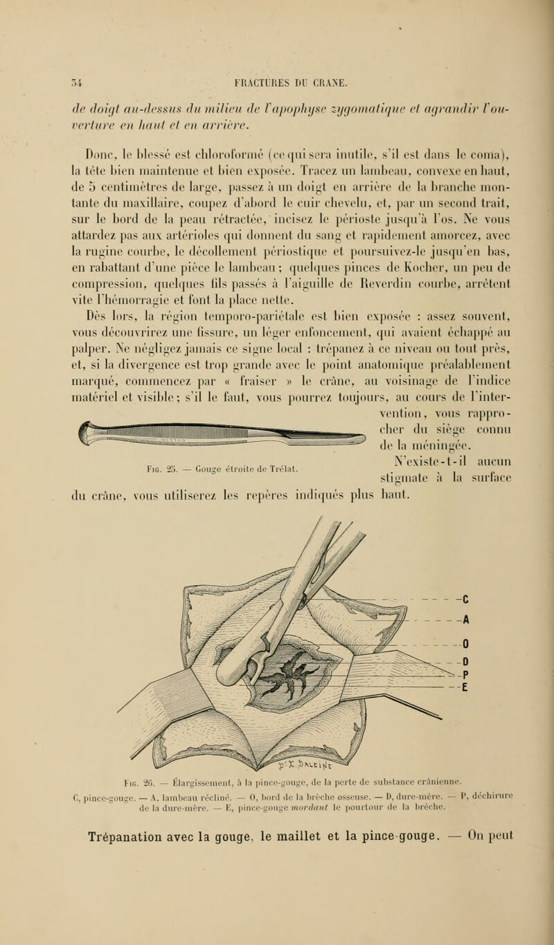 de (ln!(jl au-dessus du milieu de l'apophyse zygomatique et agrandir l'ou- verture en liant et en arrière. noue, le blessé est chloroformé (cequisera inutile, s'il est dans le coma), la tête bien maintenue et bien exposée. Tracez un lambeau, convexe en haut, de 5 centimètres de large, passez à un doigt en arrière (!<• la branche mon- tante du maxillaire, coupez d'abord le cuir chevelu, et, par un second trait, sur le bord de la peau rétractée, incise/, le périoste jusqu'à l'os. Ne vous attardez pas aux artérioles qui donnent du sang et rapidement amorcez, avec la rugine courbe, le décollement périostique et poursuivez-le jusqu'en lias, en rabattant d'une pièce le lambeau; quelques pinces de Rocher, un peu de compression, quelques lils passés à l'aiguille de Reverdin courbe, arrêtent vite l'hémorragie et t'ont la place nette. Dès lors, la région temporo-pariétale est bien exposée : assez souvent, vous découvrirez une tissure, un léger enfoncement, ipii avaient échappé au palper. Ne négligez jamais ce signe local : trépanez à ce niveau ou tout près, et, si la divergence est trop grande avec le point anatomique préalablement marqué, commencez par « fraiser » le crâne, au voisinage de l'indice matériel et visible ; s'il le faut, vous pourrez toujours, au cours de l'inter- vention, vous rappro- cher du siège connu de la méningée. „ „ „ . . , ,„ ., N'existe-t-il aucun rie *2o. — Gouge étroite de irelat. stigmate a la surlace du crâne, vous utiliserez les repères indiqués plus haut. ti.;. 26. — Élargisse m. i la pince-gouge, de la perte de substance crânienne. C, pince-gouge. — A, lambeau récliné. — 0, bord de la brèche osseuse. — D, dure-mère. P, déchirure de la dure-mère. K. pii -gouge mordant le pourtour il<- la brèche. Trépanation avec la gouge, le maillet et la pince gouge. — On peu!