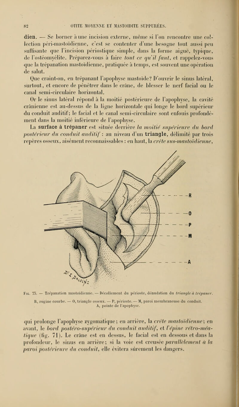 dien. — Se borner aune incision externe, même si l'on rencontre une col- lection péri-mastoïdienne, c'est se contenter d'une besogne tout aussi peu suffisante que l'incision périostique simple, dans la l'orme aiguë, typique, de l'ostéomyélite. Préparez-vous à faire tout ce qu'il faut, et rappelez-vous que la trépanation mastoïdienne, pratiquée à temps, est souvent une opération de salut. One craint-on, en trépanant l'apophyse mastoïde? D'ouvrir le sinus latéral, surtout, et encore de pénétrer dans le crâne, de blesser le nerf facial ou le canal serni-circulaire horizontal. Or le sinus latéral répond à la moitié postérieure de l'apophyse, la cavité crânienne est au-dessus de la ligne horizontale qui longe le bord supérieur du conduit auditif; le facial et le canal semi-circulaire sont enfouis profondé- ment dans la moitié inférieure de l'apophyse. La surface à trépaner est située derrière In moitié supérieure du bord postérieur du conduit auditif: au niveau d'un triangle, délimité par trois repères osseux, aisément reconnaissables : en haut, la crête sus-mastoïdienne, Fie. 75. — Trépanation mastoïdienne. — Décollement du périoste, dénudation du triangle u trépaner. R, rùgine courbe. — 0, triangle osseux. — P, périoste. — M, paroi membraneuse du conduit A, poinle de l'apophyse. qui prolonge l'apophyse zygomatique; en arrière, la criic mastoïdienne', en avant, le bord postéro-supérieur du conduit auditif, et l'épine rétro-méa- tique (fig. 71). Le crâne est en dessus, le facial est en dessous et dans la profondeur, le sinus en arrière; si la voie est creusée parallèlement à la paroi postérieure <lu conduit, elle évitera sûrement les dangers.