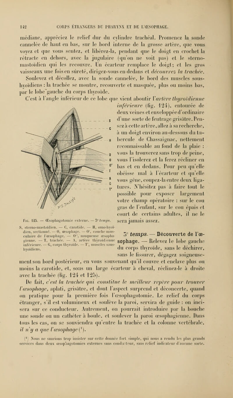 médiane, appréciez le relief dur du cylindre trachéal. Promenez la sonde cannelée de liant en lias, sur le bord interne de la grosse artère, «pie vous voyez et que vous seule/., et libérez-la, pendanl que le doigt en crochet la rétracte en dehors, avec la jugulaire (qu'on ne voit pas) et le sterno- mastoïdien qui les recouvre, lu écarteur remplace le doigt; et les gros vaisseaux une fois en sûreté, dirigez-vous en dedans et découvrez la Irai-lire. Soulevez et décolle/., avec la sonde cannelée, le bord des muscles sous- hyoïdiens : la trachée se montre, recouverte et masquée, plus ou inoins lias, par le lobe gauche du corps thyroïde. C'est à 1 angle inférieur de ce lobe que vient aboutir Vartère thyroïdienne inférieure (liij;. lw2î), entourée de deux veines et enveloppée d'ordinaire d'une suite de feutrage grisâtre. Pen- sezà cette artère, allez à sa recherche, à un doigt environ au-dessous du lu- hercule de Chassaignac, nettement reconnaissante au fond de la plaie : vous la trouverez sans trop de peine, vous l'isolerez et la ferez récliner en lias et en dedans. Pour peu qu'elle obéisse mal à l'écarteur et qu'elle vous gêne, coupez-la entre deux liga- tures. N'hésitez pas à faire tout le possible pour exposer largement votre champ opératoire : sur le cou gras de l'enfant, sur le cou épais et court de certains adultes, il ne le sera jamais assez. Fig. 125. — (Esophagotomie externe. — 3 temps. S. sterno-mastoïdien. — C, carotide. — 11, omo-hyoï- dien, sectionné. — 0, œsophage. — 0'. couche mus- culaire de l'œsophage. — 0, muqueuse œsppha gienne. — T. trachée, inférieure. — G hyoïdiens. i' temps. — Découverte de l'œ- - A, artère thyroïdienue SOphage. — Relevez le lolie gauche , corps thyroïde. — T, muscles sous- . ,, . , 1f .. ilu corps thyroïde, sans le déchirer, sans le fissurer, dégagez soigneuse- ment son bord postérieur, en vous souvenant qu'il couvre et enclave plus ou moins la carotide, et, sous un large écarteur à cheval, réclinez-le à droite avec la trachée (fig. 124 et 125). De fait, c'est ht trachée (/ai constitue le meilleur repère pour trouver l'œsophage, aplati, grisâtre, et dont l'aspect surprend et déconcerte, quand on pratique pour la première fois l'cesophagotomie. Le relief du corps étranger, s'il est volumineux cl soulève la paroi, servira de guide : on inci- sera sur ce conducteur. Autrement, on pourrait introduire par la bouche une sonde ou un cathéter à houle, et soulever la paroi œsophagienne. Dans tous les cas, on se souviendra qu'entre la trachée et la colonne vertébrale, il n'y a que l'œsophage^). 1 Nous m* saurions trop insister sur celte donnée fini simple, qui nous ■■» rendu les plus grands services dans deux oesophagotomies externes sans conducteur, sans relief indicateur d'aucune sorte.