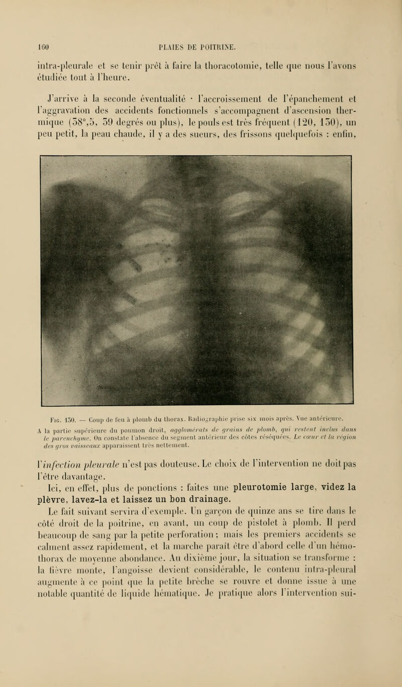 100 PLAIES 1»E I'iilTHINE. intra-pleurale et se tenir prêt à faire la thoraeotomie, telle que nous l'avons étudiée tout à l'heure. J'arrive à la seconde éventualité ■ l'accroissement de l'épanchement et I aggravation des accidents fonctionnels s'accompagnent d'ascension ther- mique (38°,5, 39 degrés ou plus), le pouls est très fréquent (120, 130), un peu petit, la peau chaude, il y a des sueurs, des frissons quelquefois : enfin, Fie. 130. — Coup de l'eu à plomb du thorax. Radiographie prise six moi- après. Vue antérieure. A la partie supérieure du poumon droit, agglomérais de grains de plomb, gui restent inclus dans le parenchyme. On constate l'absence du segment antérieur des côtes réséquées. Le cœur et lu région des gros vaisseaux apparaissent très nettement. Y infect ion pleurale n'est pas douteuse. Le choix de l'intervention ne doit pas l'être davantage. Ici, en effet, plus de ponctions : faites une pleurotomie large, videz la plèvre, lavez-la et laissez un bon drainage. Le fait suivant servira d'exemple. Un garçon de quinze ans se tire dans le côté droit de lit poitrine, en avant, un coup de pistolet à plomb. Il perd beaucoup de sang par la petite perforation ; mais les premiers accidents se calment assez rapidement, et lit marche paraîl être d'abord celle d'un hémo- thorax de moyenne abondance. Au dixième jour, la situation se transforme : la fièvre monte, l'angoisse devient considérable, le contenu intra-pleural augmente à ce point que la petite brèche se rouvre et donne issue à une