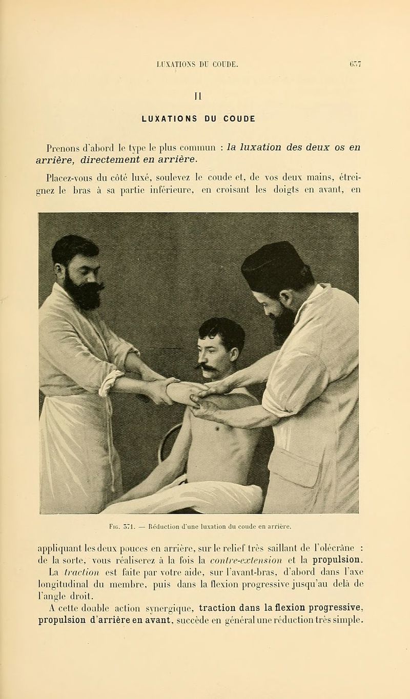 II LUXATIONS DU COUDE Prônons d'abord le type 1p plus commun : la luxation des deux os en arrière, directement en arrière. Placez-vous du côté luxé, soulevez le coude et, de vos deux mains, étrei- gnez le bras à sa partie inférieure, en croisant les doigts en avant, en Fig. 571. — Réduction d'une luxation du coude en arriè appliquant les deux pouces en arrière, sur le relief très saillant de l'olécrâne : de la sorte, vous réaliserez à la fois la contre-extension et la propulsion. La traction est faite par votre aide, sur l'avant-bras, d'abord dans 1 axe longitudinal du membre, puis dans la flexion progressive jusqu'au delà de L'angle droit. A cette double action synergique, traction dans la flexion progressive, propulsion d'arrière en avant, succède en général une réduction très simple.