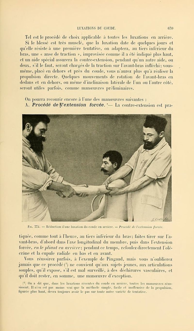 Tel est le procédé de choix applicable à toutes les luxations en arrière. Si le blessé est très musclé, que la luxation date de quelques jours et qu'elle résiste à une première tentative, on adaptera, au tiers inférieur du bras, une « anse de traction », improvisée comme il a été indiqué plus haut, et un aide spécial assurera la contre-extension, pendant qu'un autre aide, ou deux, s'il le faut, seront chargés de la traction sur l'avant-bras infléchi ; vous- même, placé en dehors et près du coude, vous n'aurez plus qu'à réaliser la propulsion directe. Quelques mouvements de rotation de lavant-bras en dedans et en dehors, ou même d'inclinaison latérale de l'un ou l'autre côté, seront utiles parfois, comme manœuvres préliminaires. On pourra recourir encore à l'une des manœuvres suivantes : A. Procédé de [l'extension forcée. '— La contre-extension est pra- E.Crité\ Fig. 57i. — Réduction d'une luxation du coude en arriére. — Procédé de l'extension forcée. tiquée, comme tout à l'heure, au tiers inférieur du bras; faites tirer sur l'a- vant-bras, d'abord dans l'axe longitudinal du membre, puis dans l'extension forcée, en le pliant en arrière; pendant ce temps, refoulez directement l'olé- cràne et la cupule radiale en bas et en avant. Vous réussirez parfois, à l'exemple de Pingaud, mais vous n'oublierez jamais que ce procédé (') ne convient qu'aux sujets jeunes, aux articulations souples, qu'il expose, s'il est mal surveillé, à des déchirures vasculaires, et qu'il doit rester, en somme, une manœuvre d'exception. (') On a dit que, clans les luxations récentes du coude en arriére, toutes les manœuvres réus- sissent. Il n'en est pas moins vrai que la méthode simple, facile et inolTensive de la propulsion, figurée plus haut, devra toujours avoir le pas sur toute autre variété de tentative.