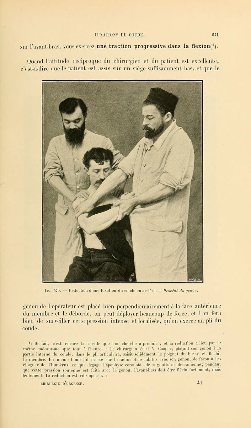 sur l'avant-bras, vous exercez nné traction progressive dans la flexioni1). Quand l'attitude réciproque du chirurgien et du patient est excellente, c'est-à-dire (jue le patient est assis sur un siège suffisamment lias, et que le Fig. 576. — Réduction d'une luxation du coude en arrière. — Procédé du genou. genou de l'opérateur est placé bien perpendiculairement à la face antérieure du membre et le déborde, on peut déployer beaucoup de force, et Ton fera bien de surveiller cette pression intense et localisée, qu'on exerce au pli du coude. (') De fait, c'est encore la bascule que l'on cherche à produire, et la réduction a lieu par le même mécanisme que tout à l'heure. « Le chirurgien, écrit A. Cooper, plaçant son genou à la partie interne du coude, dans le pli articulaire, saisit solidement le poignet du blessé et fléchit le membre. En même temps, il presse sur le radius et le cubitus avec son genou, de façon à les éloigner de l'humérus, ce qui dégage l'apophyse coronoïde delà gouttière olécranienne; pendant que cette pression soutenue est faite avec le genou, l'avant-bras doit être fléchi fortement, mais lentement. La réduction est vite opérée. » CIIIIUT.GIE D URGENCE. 41