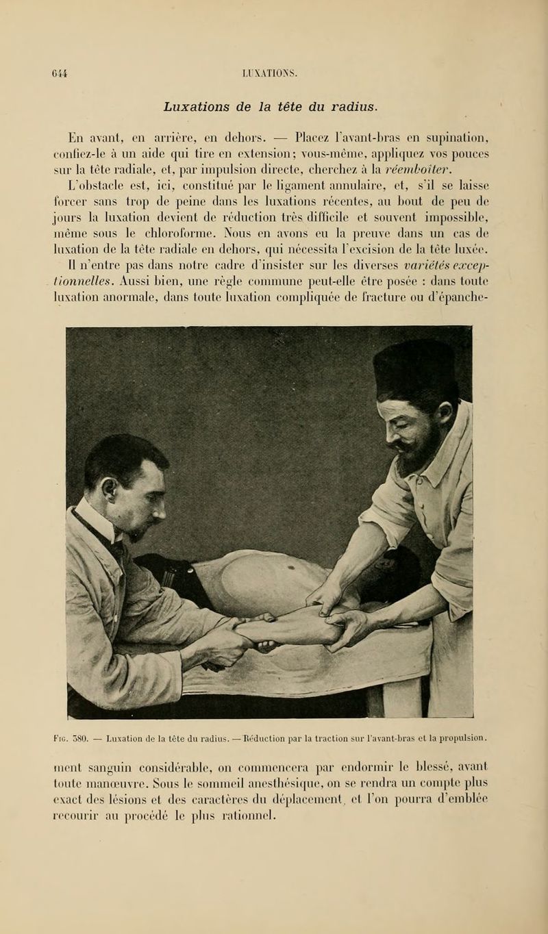 Luxations de la tête du i^adius. En avant, en arrière, en dehors. — Placez l'avant-bras en supination, confiez-le à un aide qui tire en extension; vous-même, appliquez vos pouces sur la tête radiale, et, par impulsion directe, cherchez à la réemboîter. L'obstacle est, ici, constitué par le ligament annulaire, et, s'il se laisse forcer sans trop de peine dans les luxations récentes, au bout de peu de jours la luxation devient de réduction très difficile et souvent impossible, même sous le chloroforme. Nous en avons eu la preuve dans un cas de luxation de la tète radiale en dehors, qui nécessita l'excision de la tête luxée. Il n'entre pas dans notre cadre d'insister sur les diverses variétés excep- tionnelles. Aussi bien, une règle commune peut-elle être posée : dans toute luxation anormale, dans toute luxation compliquée de fracture ou d'épanche- Fio. 380. Luxation de la tùte du radius. — Réduction par la traction sur l'avant-bras et la propulsion. ment sanguin considérable, on commencera par endormir le blessé, avant toute manœuvre. Sous le sommeil anesthésique, on se rendra un compte plus exact des lésions et des caractères du déplacement, et l'on pourra d'emblée recourir au procédé le plus rationnel.