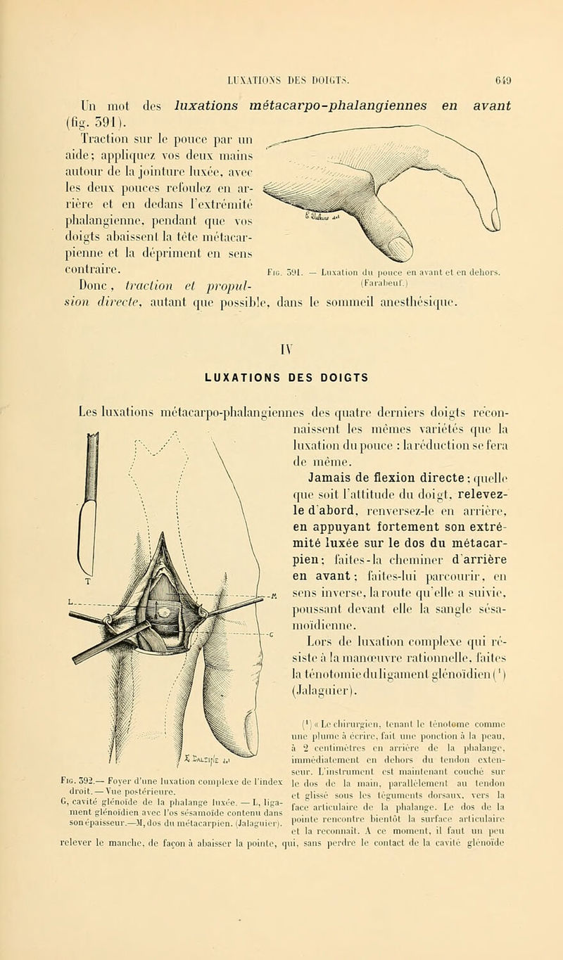 LUXATIONS DES DOIGTS. 640 Un mot des luxations métacarpo-phalangiennes en (fig. 591). Traction sur le pouce par un aide; appliquez vos deux mains autour de la jointure luxée, avec les deux pouces refoulez en ar- rière et en dedans l'extrémité phalangienne, pendant que vos doigts abaissent la tête métacar- pienne et la dépriment en sens contraire. Donc, traction et propul- sion directe, autant que possibl avant Fig. ô'.U. Luxation du pouce en avant et en dehors. (Farabeuf.) dans le sommeil anesthésique. IV LUXATIONS DES DOIGTS Les luxations métacarpo-phalangiennes des quatre derniers doigts recon- naissent les mêmes variétés que la luxation du pouce : laréduction se fera de même. Jamais de flexion directe;quelle que soit l'attitude du doigt, relevez- le d'abord, renversez-le en arrière, en appuyant fortement son extré- mité luxée sur le dos du métacar- pien ; faites-la cheminer d'arrière en avant; faites-lui parcourir, en sens inverse, la route qu'elle a suivie, poussant devant elle la sangle sésa- moïdienne. Lors de luxation complexe qui ré- siste à la manœuvre rationnelle, faites la ténotomicdu ligament glénoïdien(') (Jalaguier). (')« Le chirurgien, tenant le lénotome comme une plume à écrire, fait une ponction a la peau, à 1 centimètres en arriére de la phalange, immédiatement en dehors du tendon exten- seur. L'instrument est maintenant couché sur Fie. 392.—Foyer d'une luxation complexe de l'index lc dos de la main, parallèlement au tendon droit—Vue postérieure. et ffUssù s01]s ,cs te&umcnts dorsaux, vers la l», cavité glenoïde de la phalange luxée. — L, liga- r ,■„ i„' i i i i i i i i _„ , ,. .... ,/ .  _ ' ,° face articulaire de la phalange. Le dos de la ment glenoidien avec 1 os sésamoide contenu dans sonépaisseur.—M,dos du métacarpien. (Jalaguier). pointe rencontre bientôt la surface articulaire et la reconnaît. A ce moment, il faut un peu relever le manche, de façon à abaisser la pointe, qui, sans perdre le contact de la cavité glenoïde