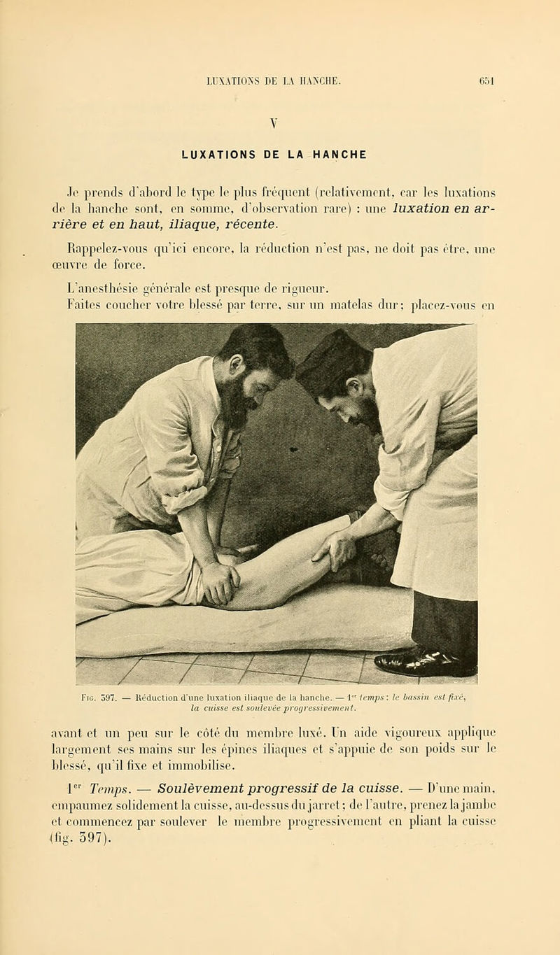 LUXATIONS DE LA HANCHE Je prends d'abord le type le plus fréquent (relativement, car les luxations de la hanche sont, en somme, d'observation rare) : une luxation en ar- rière et en haut, iliaque, récente. Rappelez-vous qu'ici encore, la réduction n'est pas, ne doit pas être, une œuvre de force. L'anesthésie générale est presque de rigueur. Faites coucher votre blessé par terre, sur un matelas dur ; placez-vous en Fjg. 597. — Réduction d'une luxation iliaque de la hanche. — 1 lemjis : le bassin est fixe, la cuisse est soulevée progressivement. avant et un peu sur le côté du membre luxé. Un aide vigoureux applique largement ses mains sur les épines iliaques et s'appuie de son poids sur le blessé, qu'il fixe et immobilise. 1er Temps. — Soulèvement progressif de la cuisse. — D'une main, empaumez solidement la cuisse, au-dessus du jarret ; de l'autre, prenez la jambe et commencez par soulever le membre progressivement en pliant la cuisse («g. 397).